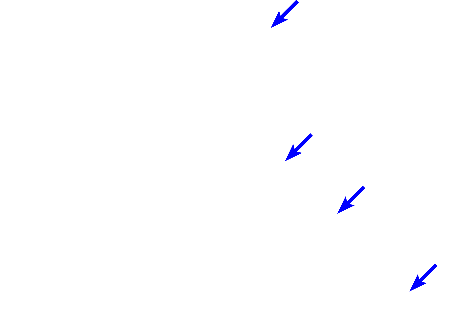  - Adipocytes  <p>The epicardium (visceral pericardium, black arrows) is a serous membrane (serosa) of variable thickness, forming the outermost tunic of the heart.  The connective tissue portion of this layer lies adjacent to the myocardium and is covered by a simple squamous epithelium (mesothelium) that faces the pericardial space.  Coronary vessels, nerves and adipocytes are located in this layer.  10x, 100x</p>
