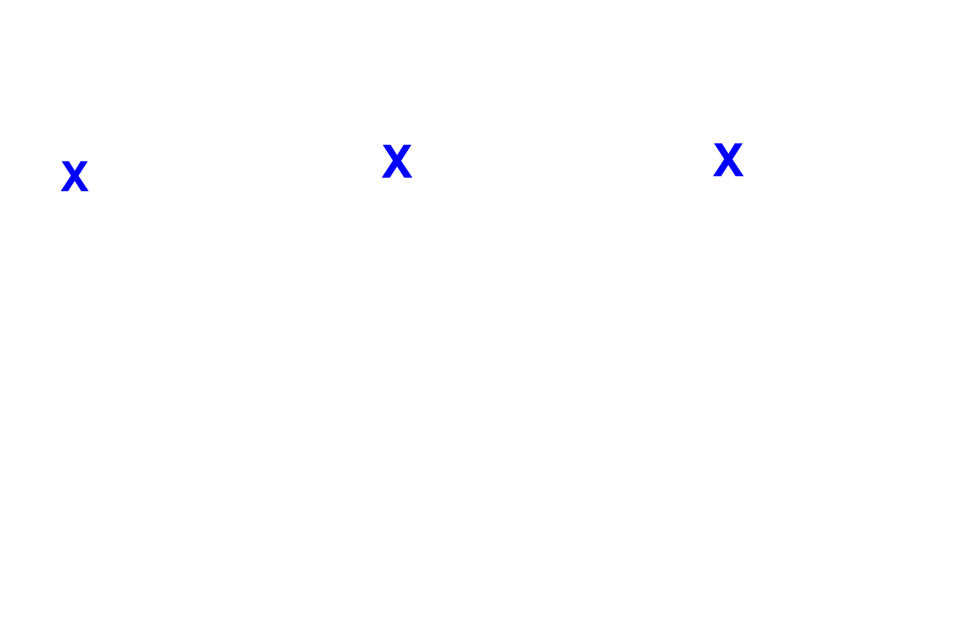 Right atrium <p>The interventricular septum, separating the two ventricles, consists of muscular and membranous portions.  Also shown are aortic and right atrioventricular valves, the cardiac skeleton and the conducting system (in blue).  The box in the left diagram shows the region where the micrograph (right) was taken; the central diagram is an illustration of the micrograph.  10x</p>
