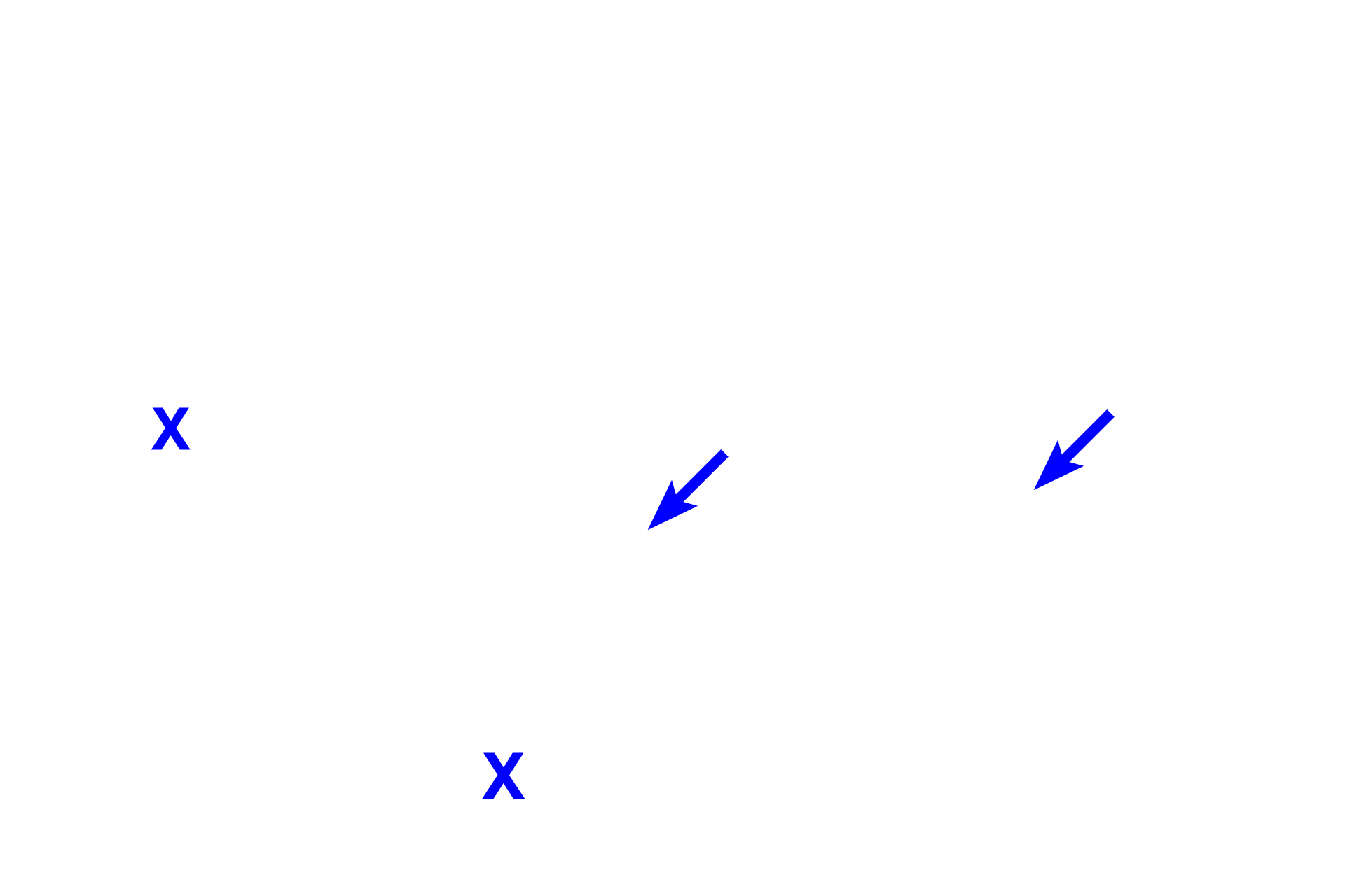 Right ventricle <p>The interventricular septum, separating the two ventricles, consists of muscular and membranous portions.  Also shown are aortic and right atrioventricular valves, the cardiac skeleton and the conducting system (in blue).  The box in the left diagram shows the region where the micrograph (right) was taken; the central diagram is an illustration of the micrograph.  10x</p>
