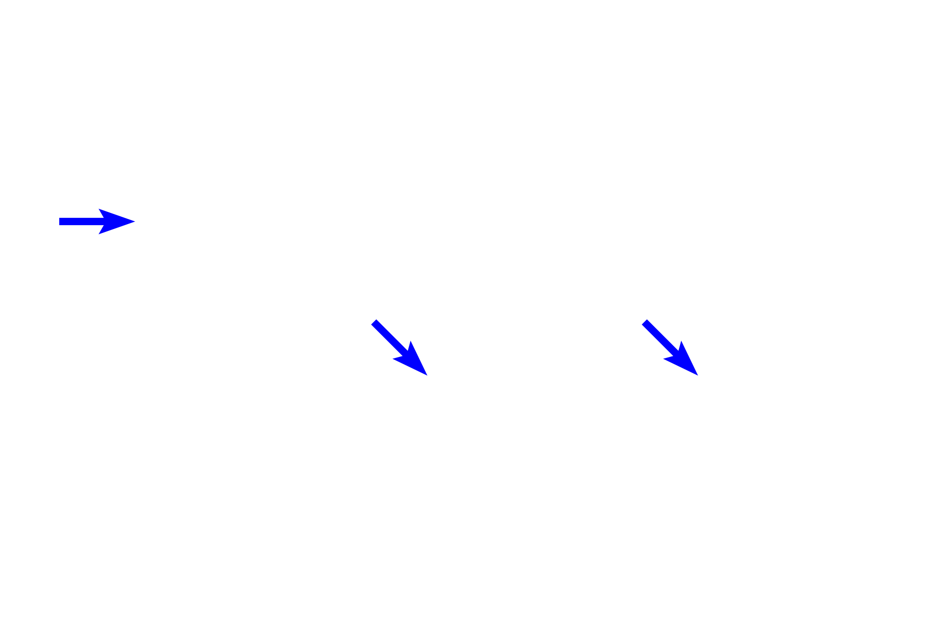 Right atrioventricular valve leaflet <p>The interventricular septum, separating the two ventricles, consists of muscular and membranous portions.  Also shown are aortic and right atrioventricular valves, the cardiac skeleton and the conducting system (in blue).  The box in the left diagram shows the region where the micrograph (right) was taken; the central diagram is an illustration of the micrograph.  10x</p>
