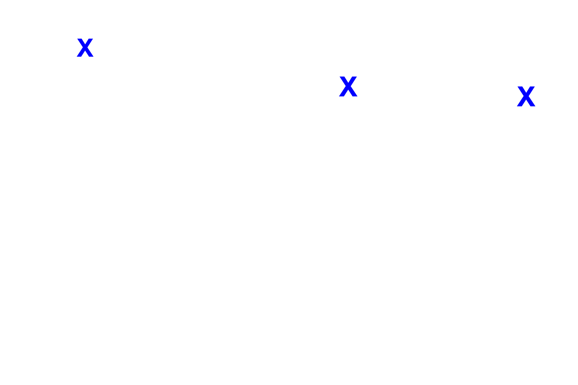 Aorta <p>The interventricular septum, separating the two ventricles, consists of muscular and membranous portions.  Also shown are aortic and right atrioventricular valves, the cardiac skeleton and the conducting system (in blue).  The box in the left diagram shows the region where the micrograph (right) was taken; the central diagram is an illustration of the micrograph.  10x</p>
