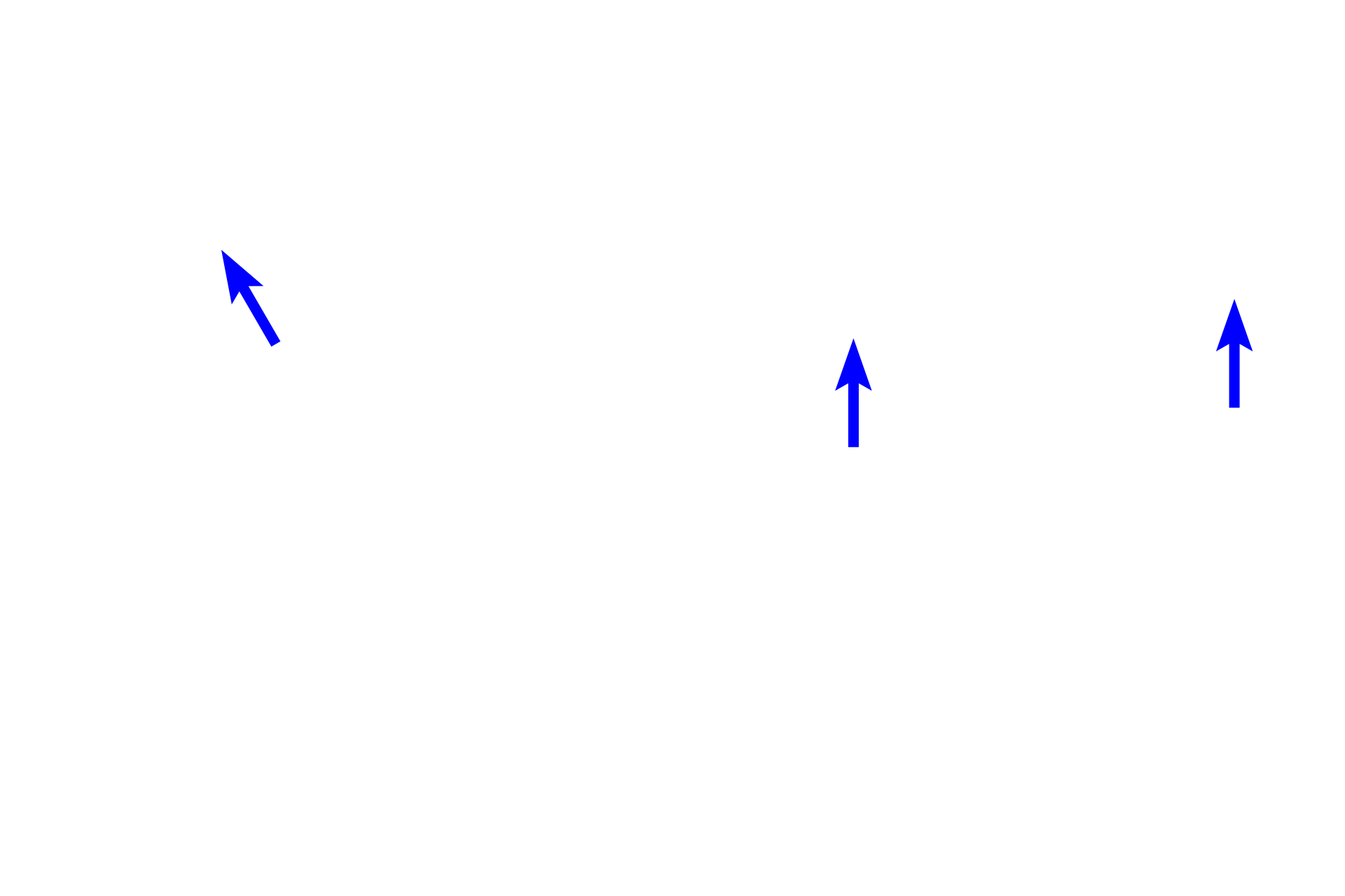 Aortic valve leaflet <p>The interventricular septum, separating the two ventricles, consists of muscular and membranous portions.  Also shown are aortic and right atrioventricular valves, the cardiac skeleton and the conducting system (in blue).  The box in the left diagram shows the region where the micrograph (right) was taken; the central diagram is an illustration of the micrograph.  10x</p>
