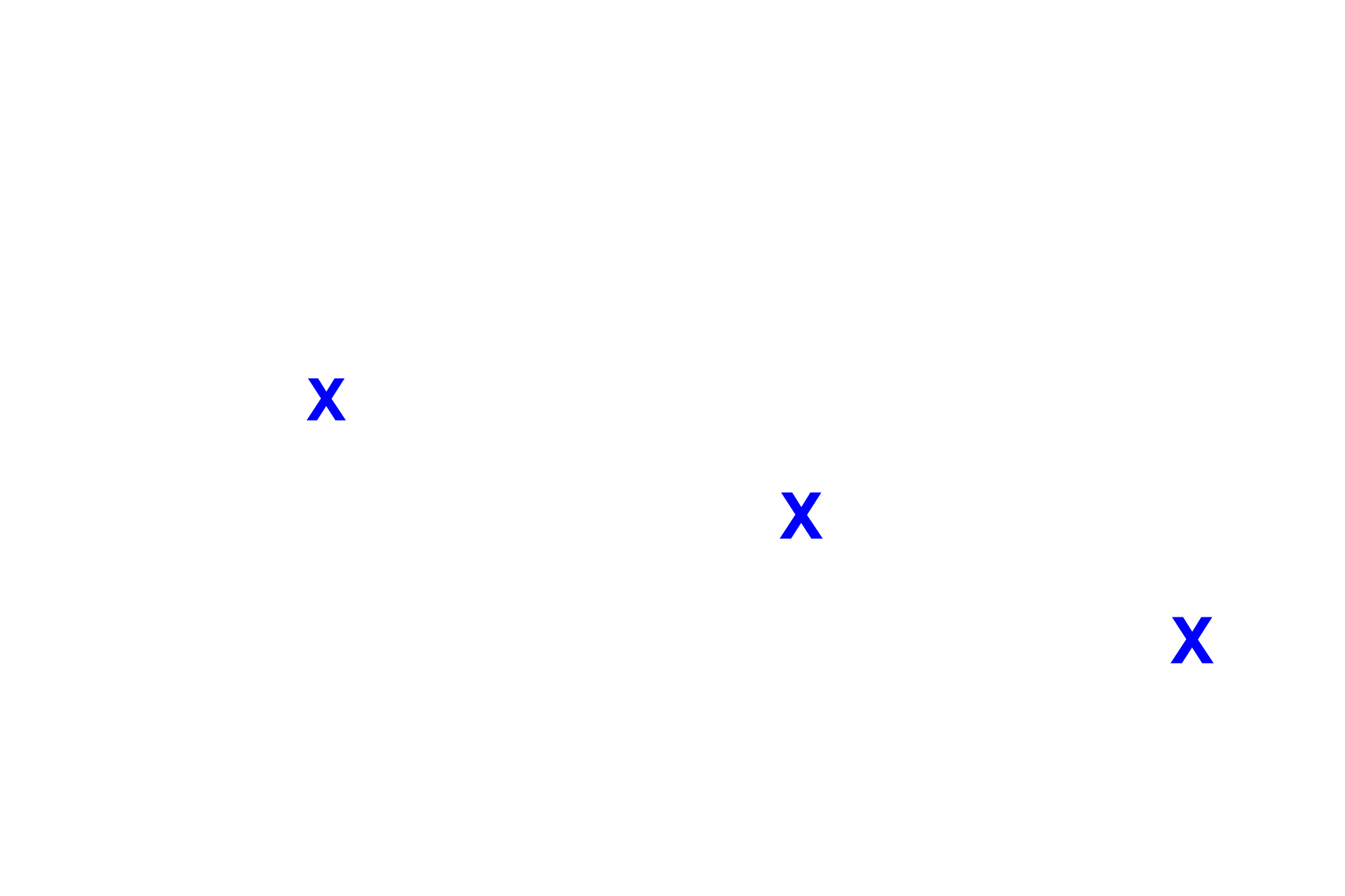Left ventricle <p>The interventricular septum, separating the two ventricles, consists of muscular and membranous portions.  Also shown are aortic and right atrioventricular valves, the cardiac skeleton and the conducting system (in blue).  The box in the left diagram shows the region where the micrograph (right) was taken; the central diagram is an illustration of the micrograph.  10x</p>
