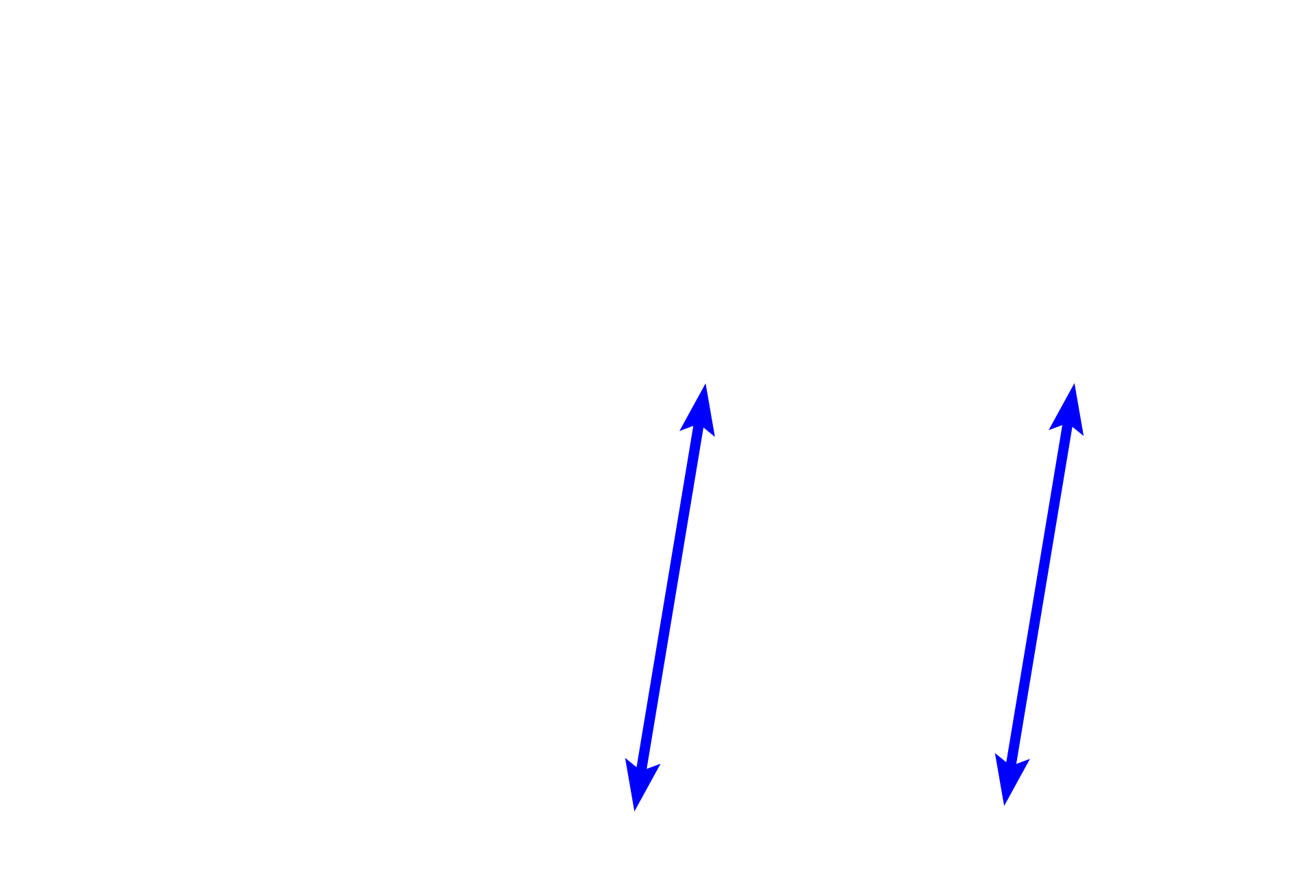 Interventricular septum <p>The interventricular septum, separating the two ventricles, consists of muscular and membranous portions.  Also shown are aortic and right atrioventricular valves, the cardiac skeleton and the conducting system (in blue).  The box in the left diagram shows the region where the micrograph (right) was taken; the central diagram is an illustration of the micrograph.  10x</p>
