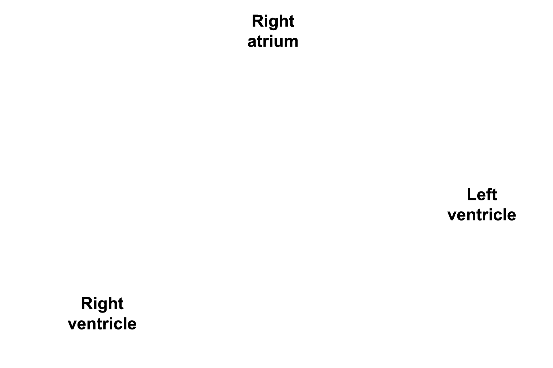 Heart chambers <p>This section of the heart includes the muscular and membranous portions of the interventricular septum and the right atrioventricular valve.  40x</p>
