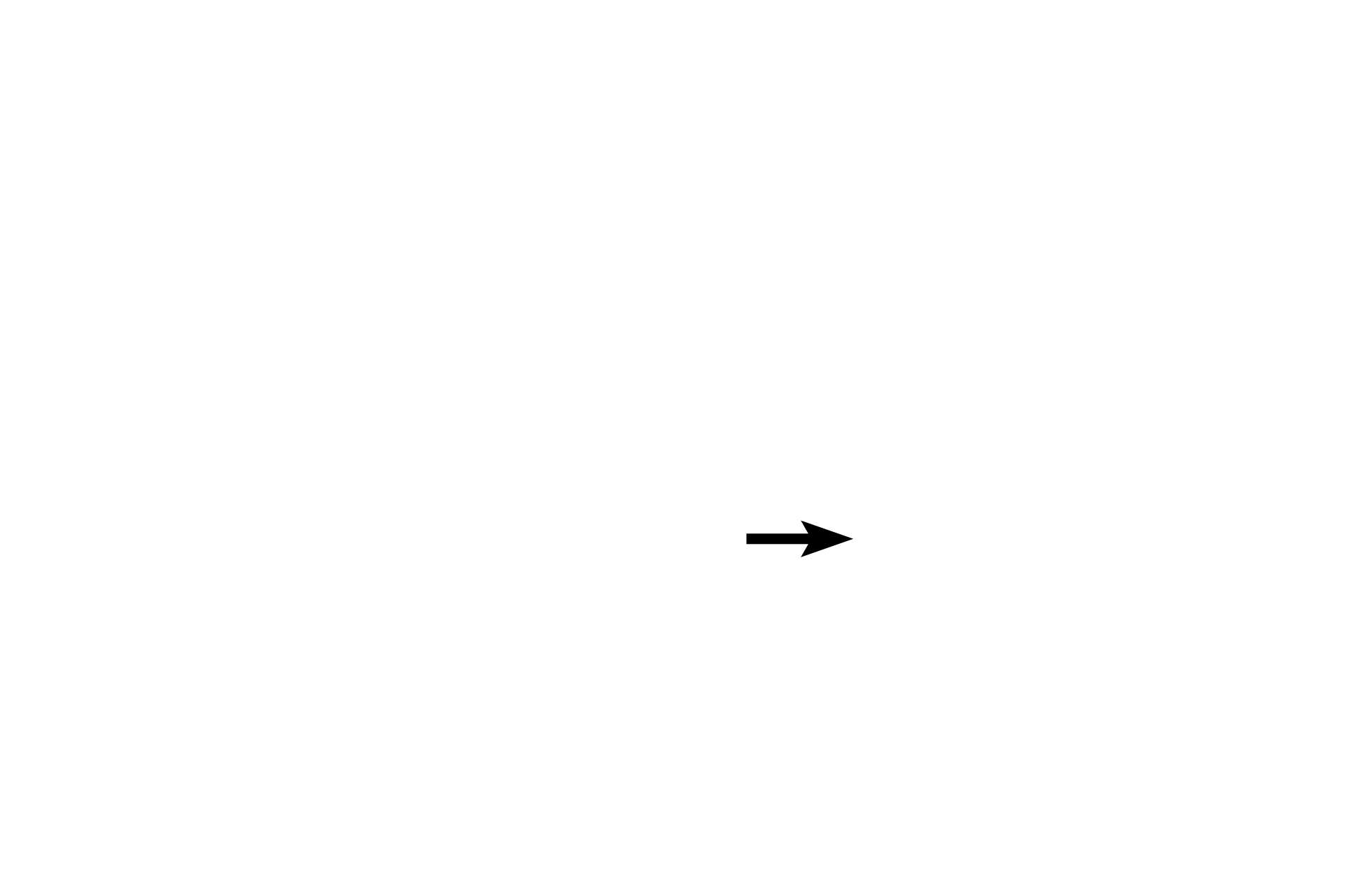  - Right bundle branch <p>The atrioventricular (AV) bundle, part of the conducting system, is in septum membranaceum just above the muscular part of the septum.  Right and left bundle branches begin in the AV bundle and conduct impulses to the right and left ventricles, respectively.  Fibers in these three subdivisions are modified cardiac muscle fibers that are usually smaller than normal cardiac fibers.</p>
