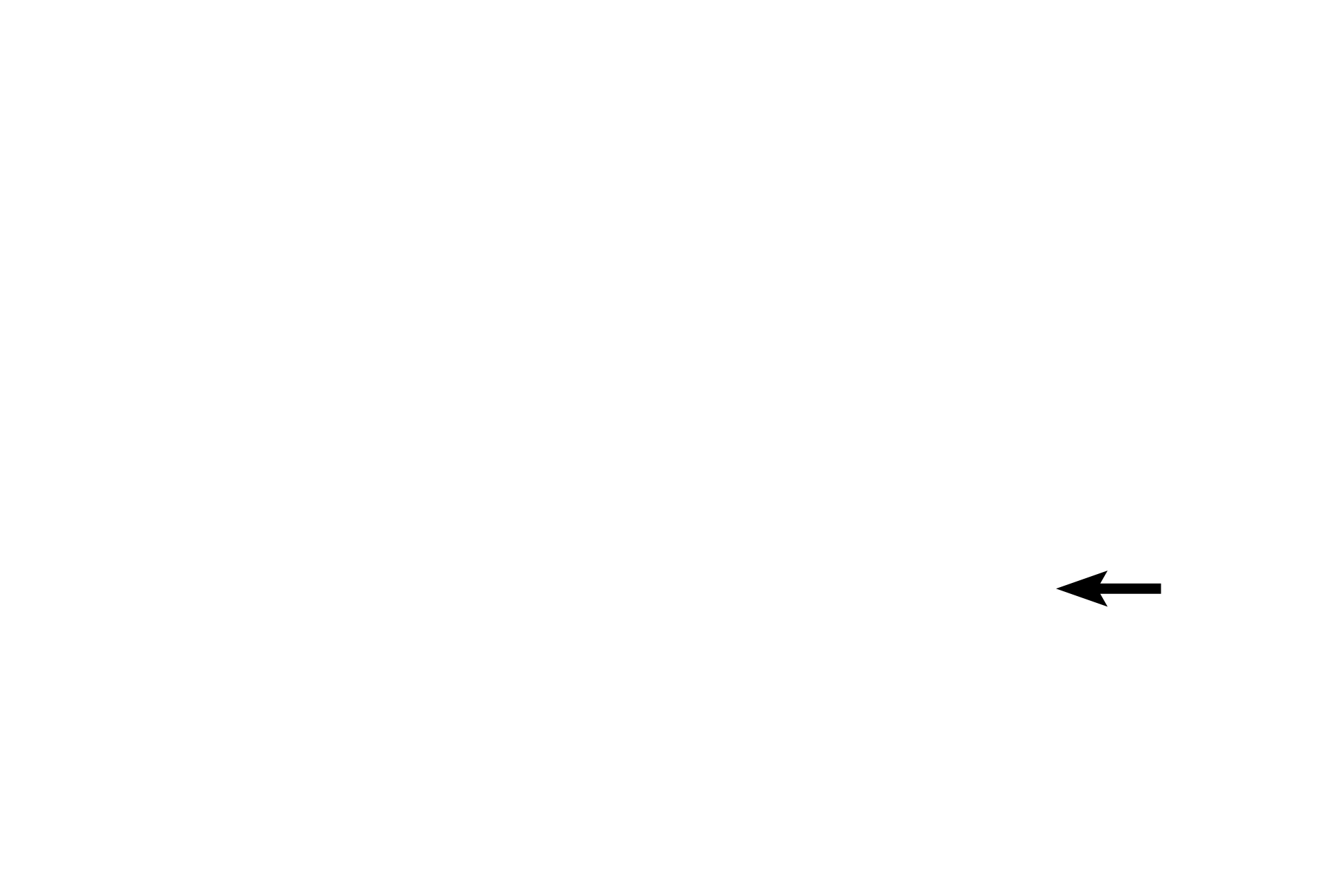  - Left bundle branch <p>The atrioventricular (AV) bundle, part of the conducting system, is in septum membranaceum just above the muscular part of the septum.  Right and left bundle branches begin in the AV bundle and conduct impulses to the right and left ventricles, respectively.  Fibers in these three subdivisions are modified cardiac muscle fibers that are usually smaller than normal cardiac fibers.</p>
