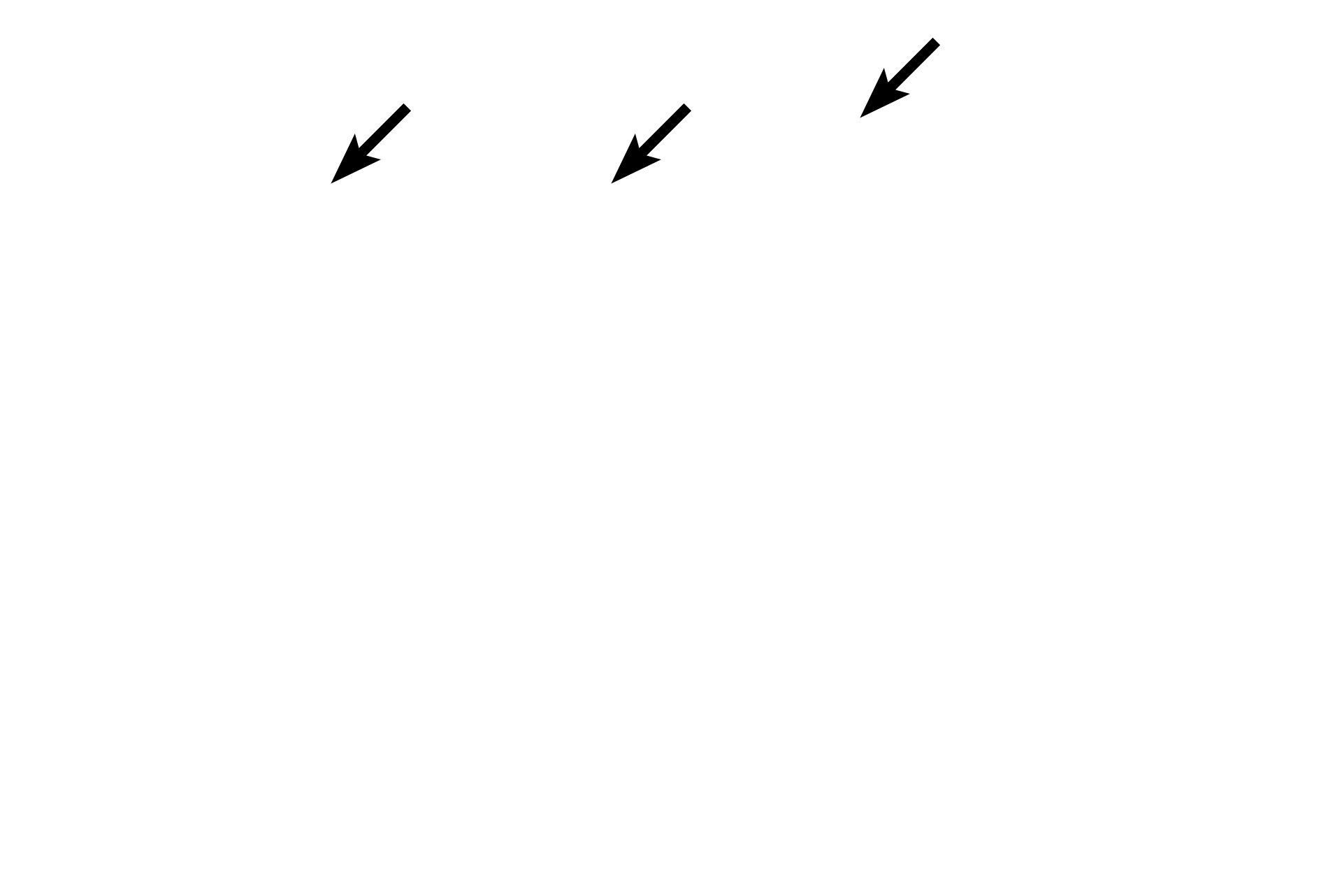 Tunica intima <p>The tunica intima is composed of an endothelium, a subendothelial connective tissue and a prominent internal elastic lamina. The tunica media, composed mostly of smooth muscle, is the thickest layer and extends up to the multilayered external elastic lamina. The tunica adventitia begins at the external elastic lamina and is composed of irregular dense connective tissue. 400x</p>
