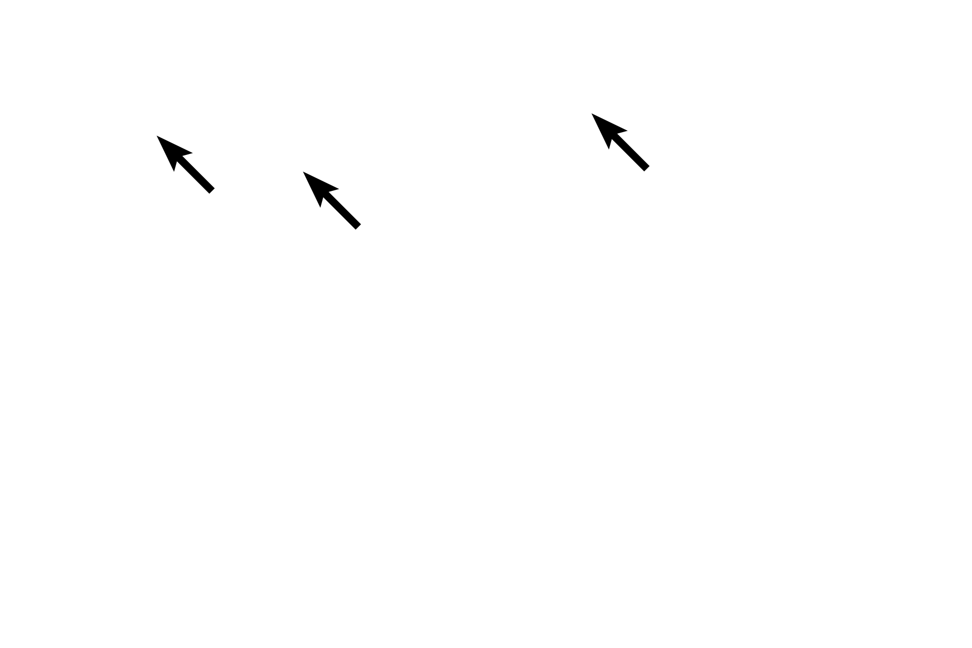  - Internal elastic lamina <p>The tunica intima is composed of an endothelium, a subendothelial connective tissue and a prominent internal elastic lamina. The tunica media, composed mostly of smooth muscle, is the thickest layer and extends up to the multilayered external elastic lamina. The tunica adventitia begins at the external elastic lamina and is composed of irregular dense connective tissue. 400x</p>
