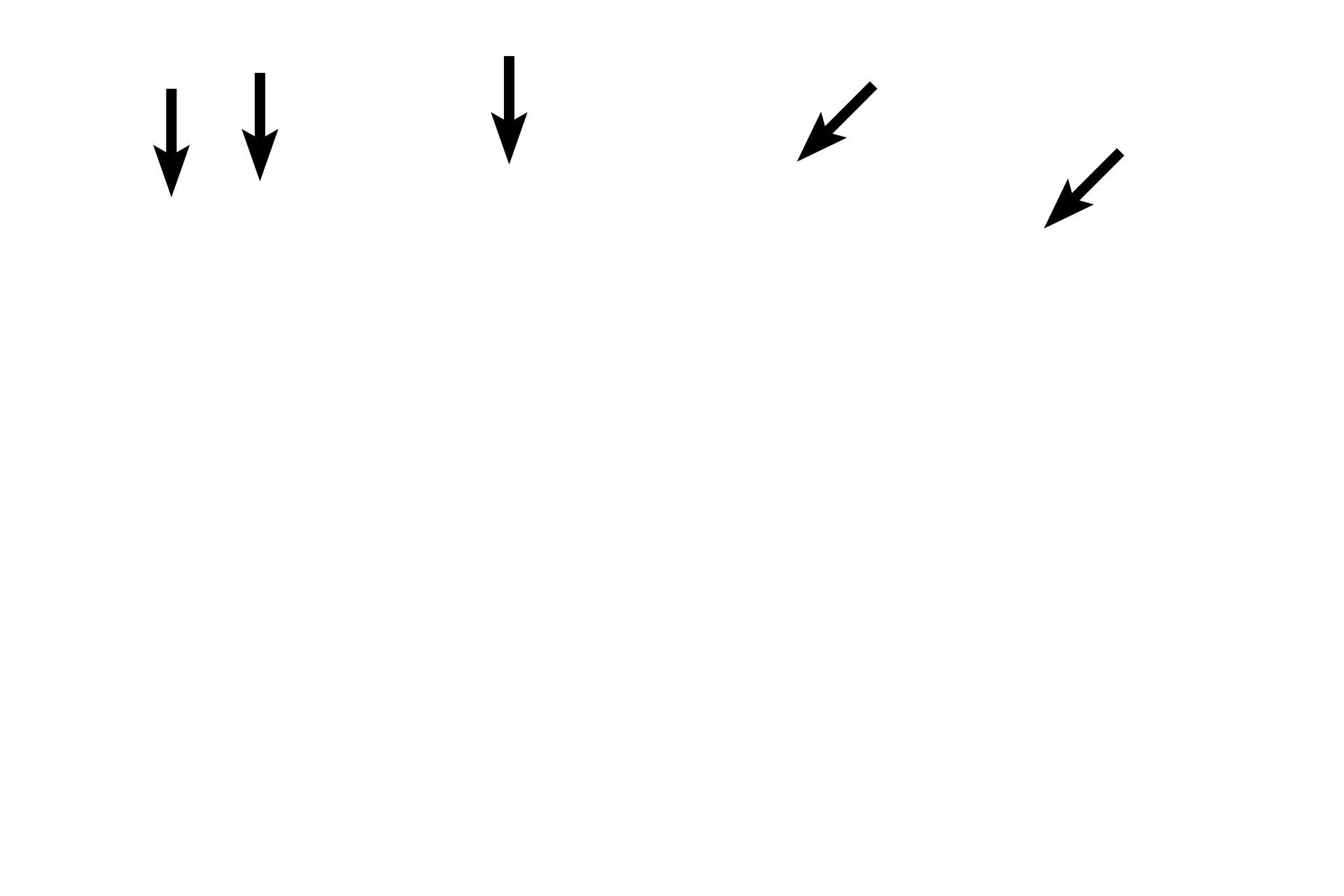  - Endothelium <p>These two images show the details of the tunica intima. This thin layer is composed of an endothelium, a loose subendothelial connective tissue and the wavy, internal elastic lamina. The internal elastic lamina is very prominent in medium, muscular arteries and aids in identifying these vessels. 1000x</p>
