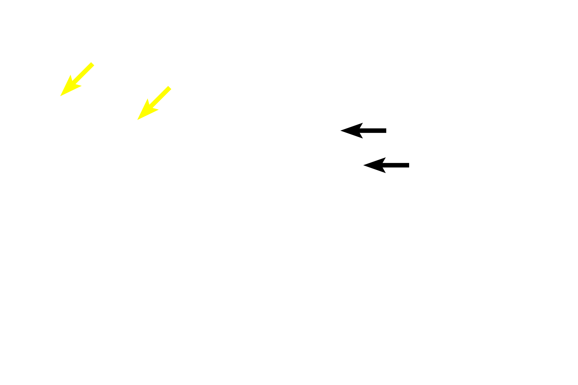 Tunica media <p>This image shows a small artery and vein coursing through connective tissue, along with a peripheral nerve. Arteries and veins of similar caliber often travel together in such a neurovascular bundle. These smaller vessels retain the same structural characteristics as larger ones. The small artery has a thick, distinct, muscular tunica media and a narrow lumen, while the vein consists primarily of a tunica adventitia and has a larger lumen. 100x</p>

