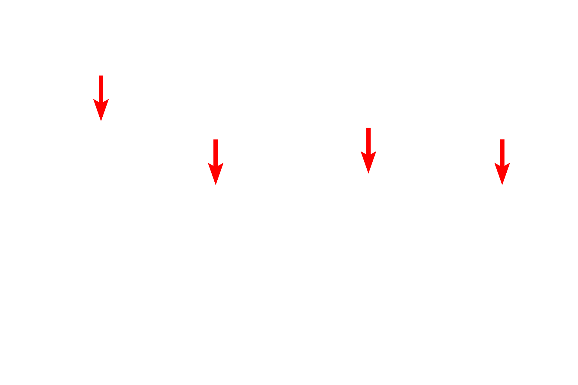 Tunica media <p>These small arteries were stained with dyes that demonstrate elastin, thus displaying the internal elastic lamina. This lamina was interrupted in the artery on the left, marking the branch point for a smaller vessel. Only fragments of the external elastic laminae remain here. The endothelial cells are distorted into a cuboid shape resulting from the constriction of the artery. 400x</p>
