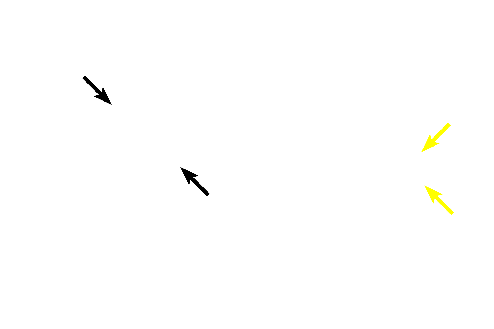   - Internal elastic lamina <p>Small arteries have three to eight layers of smooth muscle in the tunica media and an internal elastic lamina is generally present. The smallest arteries, like the one shown on the right, lead into arterioles, which are the main regulators of blood pressure. 700x, 1000x</p>
