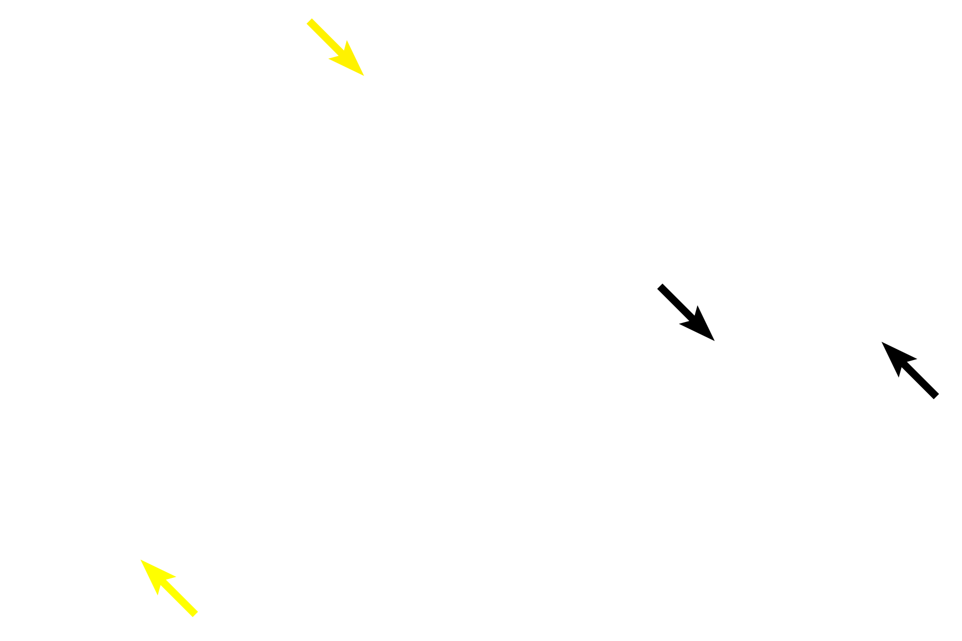 Tunica adventitia <p>Small arteries have three to eight layers of smooth muscle in the tunica media and an internal elastic lamina is generally present. The smallest arteries, like the one shown on the right, lead into arterioles, which are the main regulators of blood pressure. 700x, 1000x</p>
