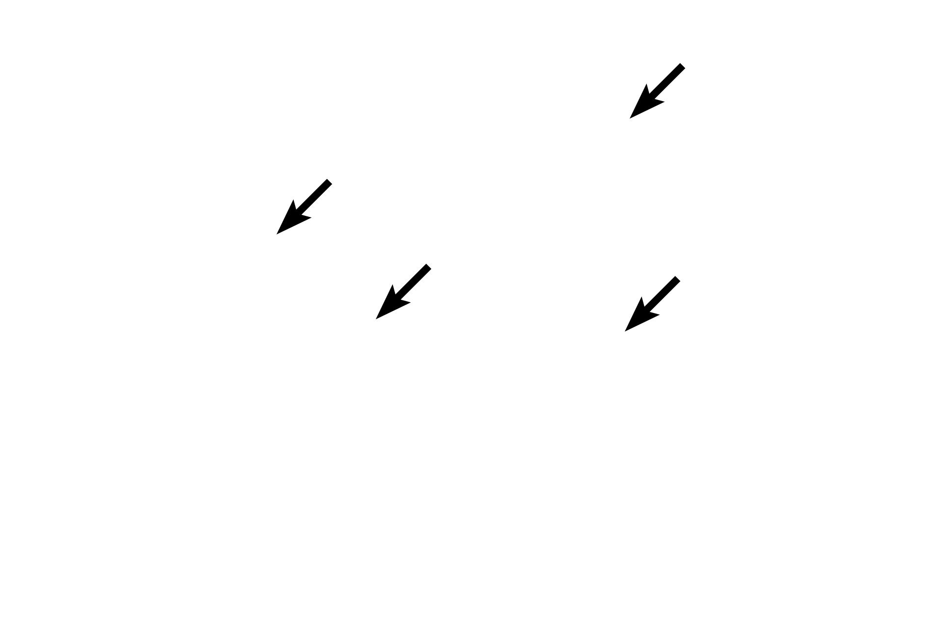  - Elastic lamellae <p>The tunica intima of an elastic artery consists of an endothelium and underlying connective tissue. An internal elastic lamina is not readily visible, because it blends with the elastic lamellae in tunica media. The thickest layer is tunica media, composed of circularly arranged smooth muscle cells, alternating with fenestrated elastic lamellae. The tunica adventitia is composed of connective tissue.  200x</p>
