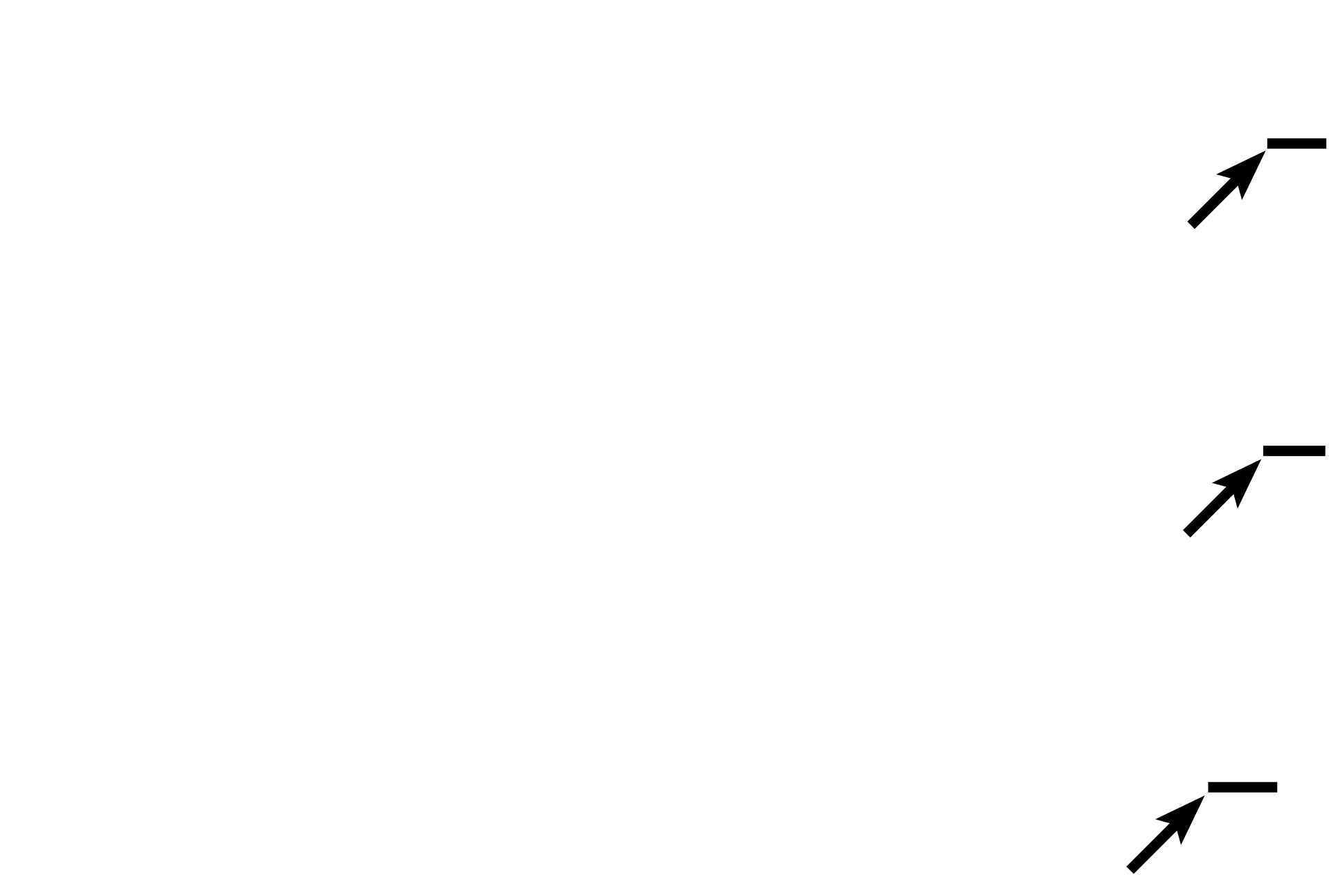 Tunica adventitia <p>The tunica intima of an elastic artery consists of an endothelium and underlying connective tissue. An internal elastic lamina is not readily visible, because it blends with the elastic lamellae in tunica media. The thickest layer is tunica media, composed of circularly arranged smooth muscle cells, alternating with fenestrated elastic lamellae. The tunica adventitia is composed of connective tissue.  200x</p>
