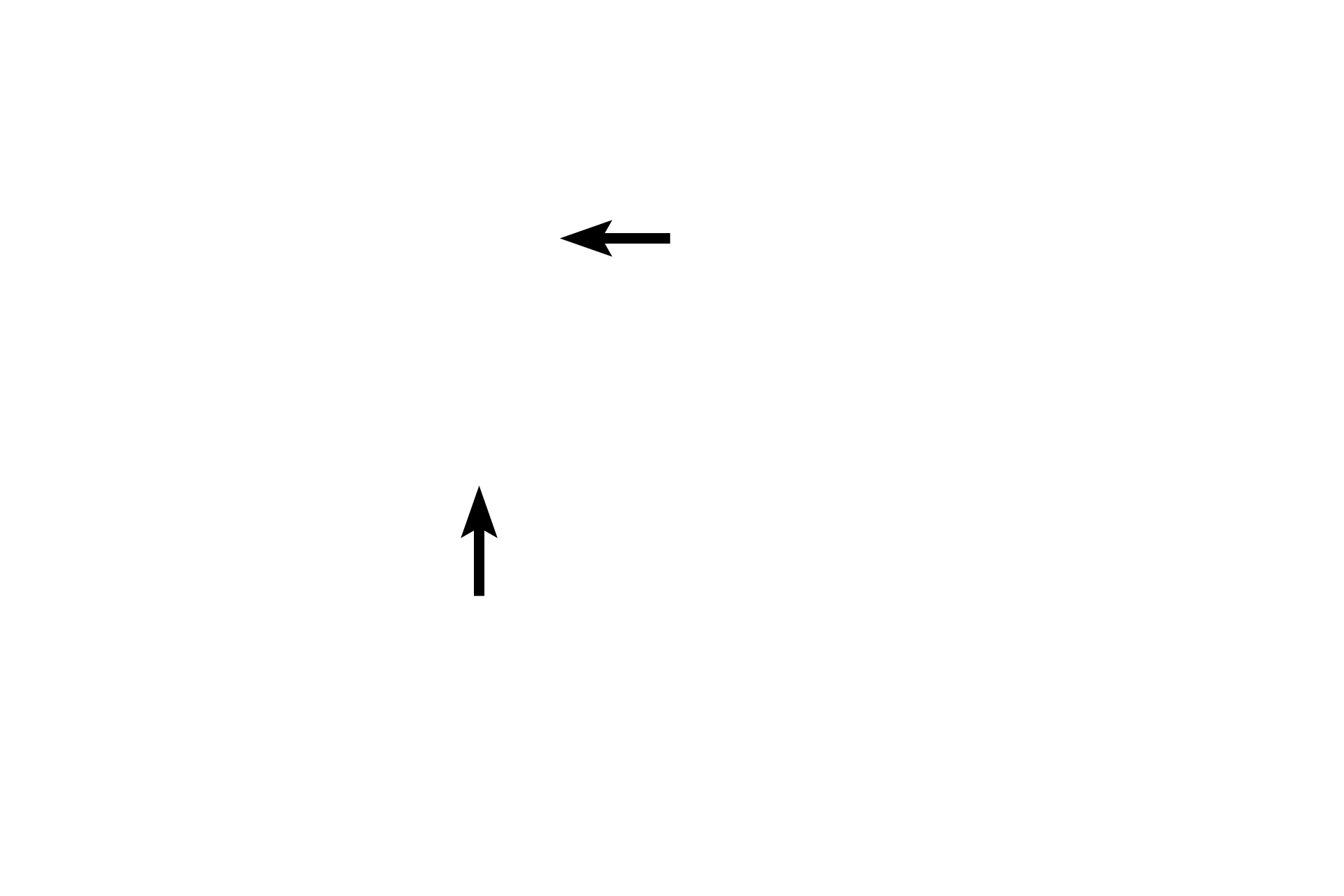 Tunica media <p>An arteriole consists of a tunica intima, a thin tunica media of one to two layers of smooth muscle cells and a tunica adventitia. The wall of the adjacent venule is thinner and less regular, consisting only of an endothelium, forming the tunica intima. A tunica media is absent and the thin tunica adventitia is indistinguishable from the surrounding connective tissue. 1000x</p>
