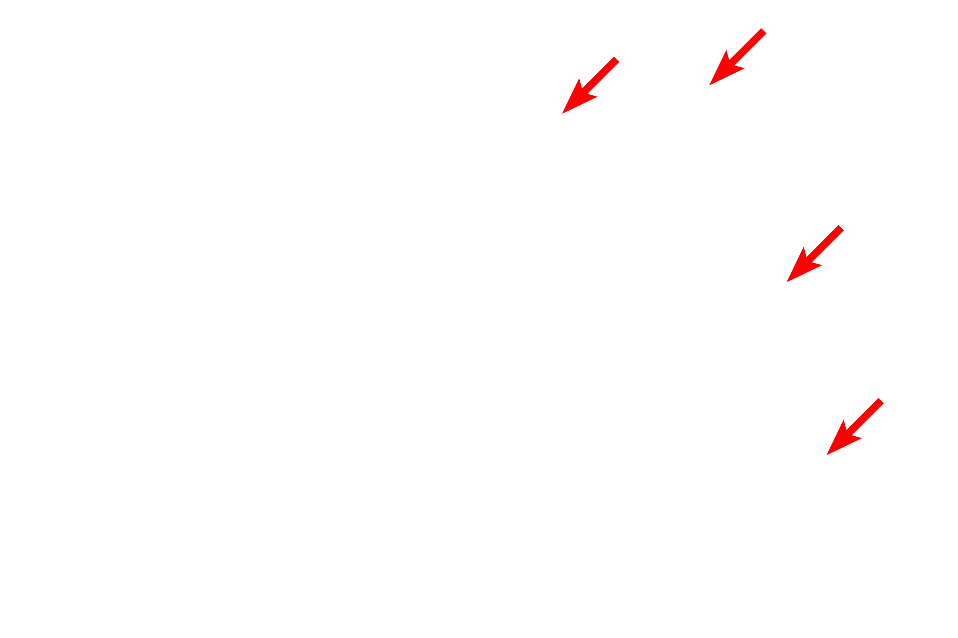  - Endothelial cells <p>This electron micrograph shows a portion of the wall of an arteriole with two layers of smooth muscle cells. Some of the space between the smooth muscle cells is due to artifactual shrinkage during fixation. The endothelial cells lie immediately above the internal elastic lamina and a portion of the tunica adventitia with fibroblast processes is visible in the lower left. 10,000x</p>
