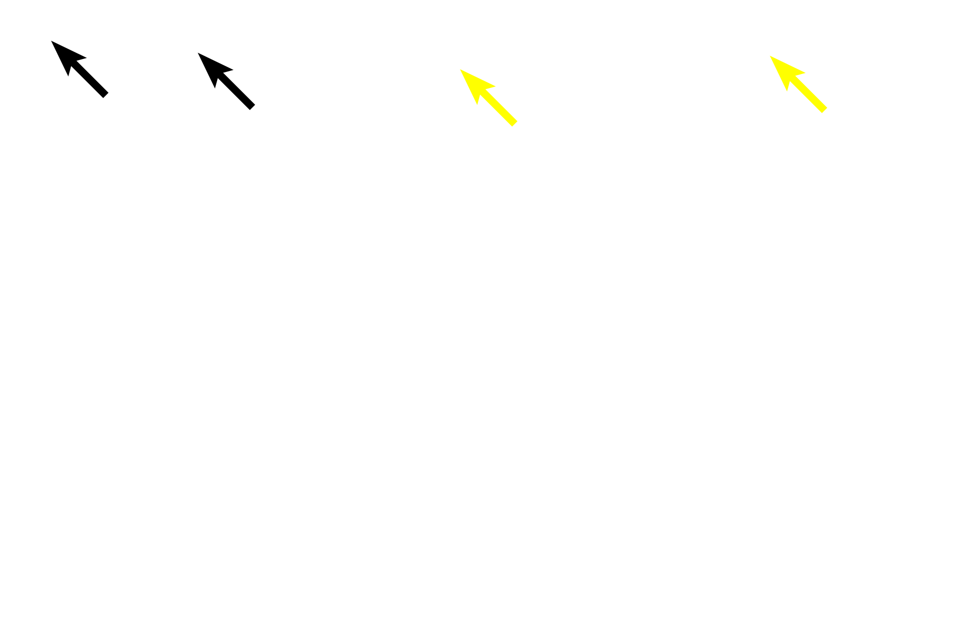 Tunica intima <p>These images compare the aortic wall stained with hematoxylin and eosin (left) with that stained for elastin, the major protein found in elastic fibers and sheets. The tunica media of an elastic artery is composed of circularly arranged smooth muscle cells and fenestrated elastic lamellae. The elastic sheets produced by the smooth muscle cells appear black with the elastin stain. 100x</p>
