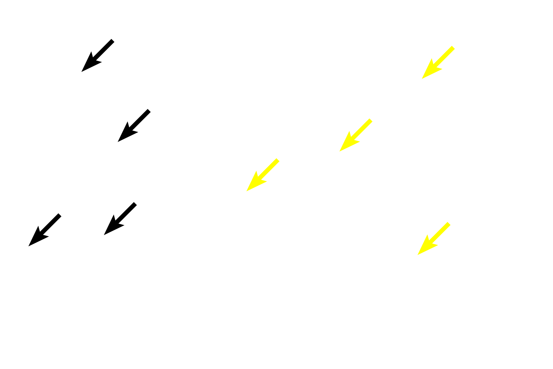  - Elastic lamellae <p>These images compare the aortic wall stained with hematoxylin and eosin (left) with that stained for elastin, the major protein found in elastic fibers and sheets. The tunica media of an elastic artery is composed of circularly arranged smooth muscle cells and fenestrated elastic lamellae. The elastic sheets produced by the smooth muscle cells appear black with the elastin stain. 100x</p>
