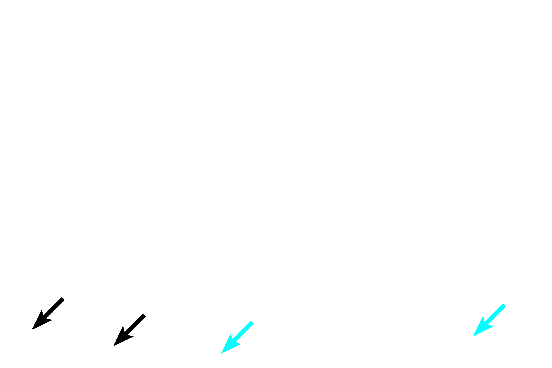 Tunica adventitia <p>These images compare the aortic wall stained with hematoxylin and eosin (left) with that stained for elastin, the major protein found in elastic fibers and sheets. The tunica media of an elastic artery is composed of circularly arranged smooth muscle cells and fenestrated elastic lamellae. The elastic sheets produced by the smooth muscle cells appear black with the elastin stain. 100x</p>
