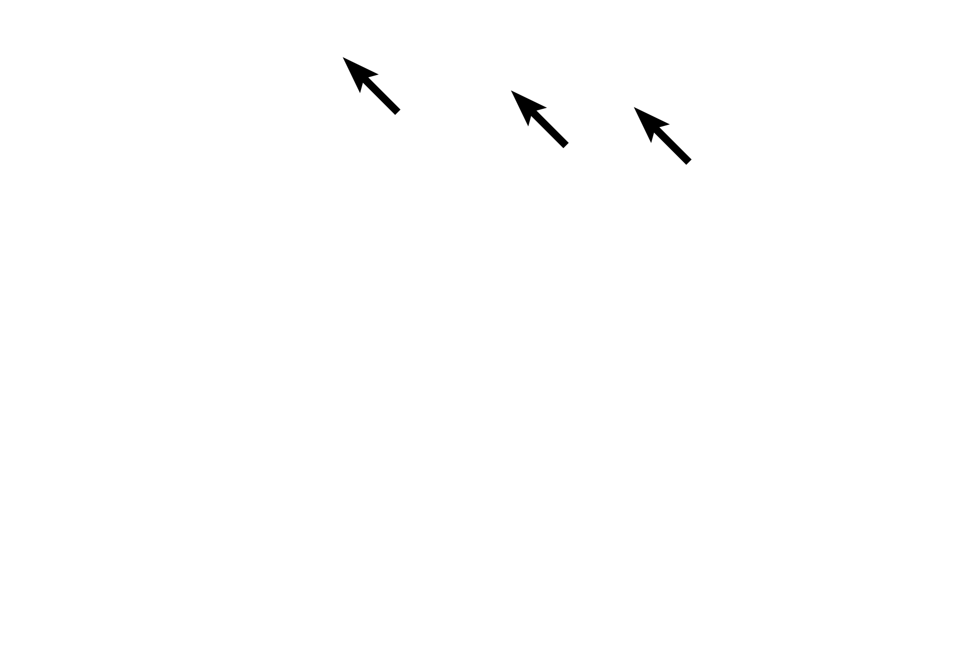  - Endothelial cells <p>At high magnification, the endothelium and underlying connective tissue of the tunica intima are visible in an elastic artery. A few smooth muscle fibers may be present in the tunica intima. The internal elastic lamina is difficult to distinguish from the elastic lamellae in the tunica media. 100x, 1000x</p>
