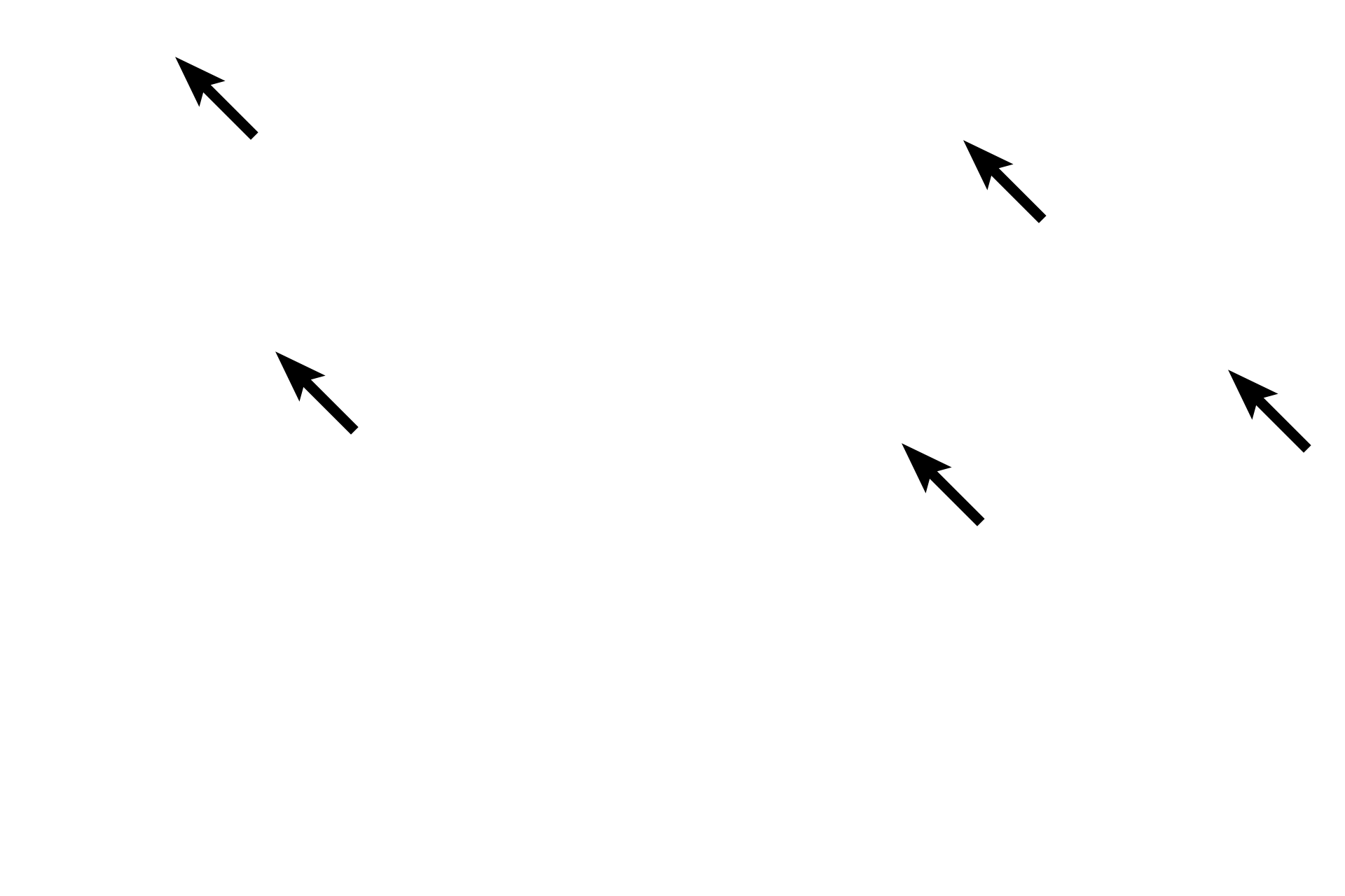 Elastic lamellae <p>The tunica media of an elastic artery is composed of 40-70 concentrically-arranged, fenestrated, elastic lamellae and smooth muscle cells. These smooth muscle cells produce the lamellae and are located between them. 1000x</p>
