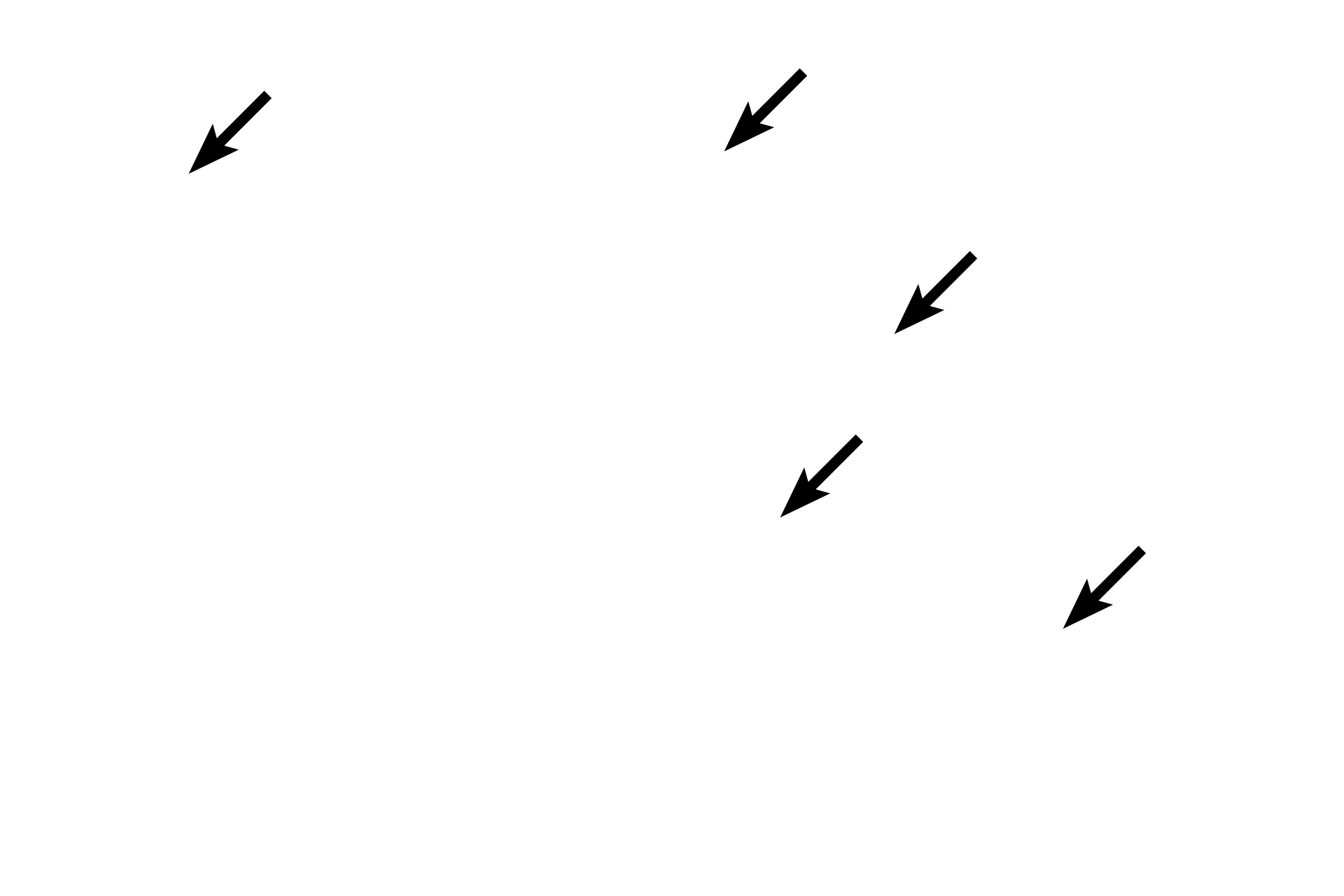 Smooth muscle cells <p>The tunica media of an elastic artery is composed of 40-70 concentrically-arranged, fenestrated, elastic lamellae and smooth muscle cells. These smooth muscle cells produce the lamellae and are located between them. 1000x</p>
