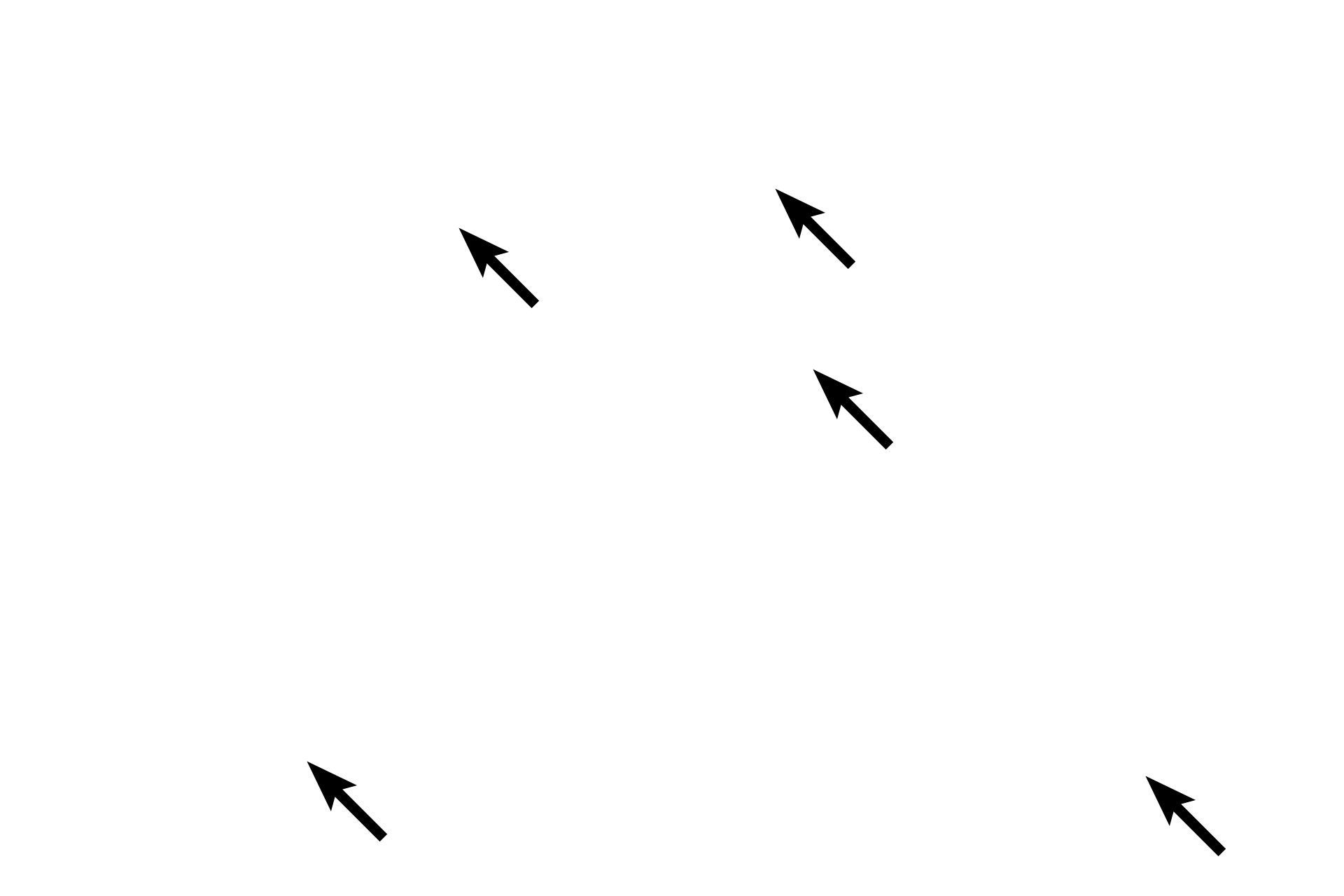 Elastic lamellae <p>At higher magnification, the tunica media of an elastic artery demonstrates the wavy, elastic lamellae alternating with smooth muscle cells. These elastic lamellae absorb the pressure generated by the contraction of the ventricles of the heart. The pressure produced by the recoil of the lamellae facilitates the uniform movement of the blood through the arterial system. 1200x</p>
