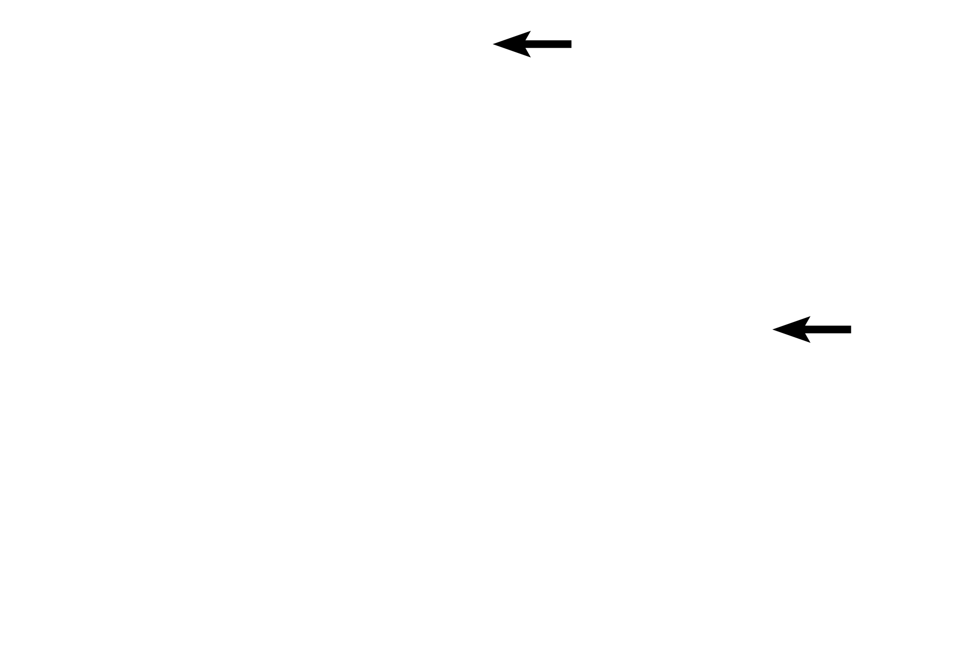 Arterioles <p>Vasa vasorum are small blood vessels (arterioles, capillaries, and venules) in the tunica media of larger blood vessels. Vasa vasorum are most obvious in the tunica adventitia, but are also present in the outer tunica media. These vessels supply the outer regions of the tunica media. The tunica intima and inner tunica media are supplied by diffusion from the lumen of the vessel. 400x</p>
