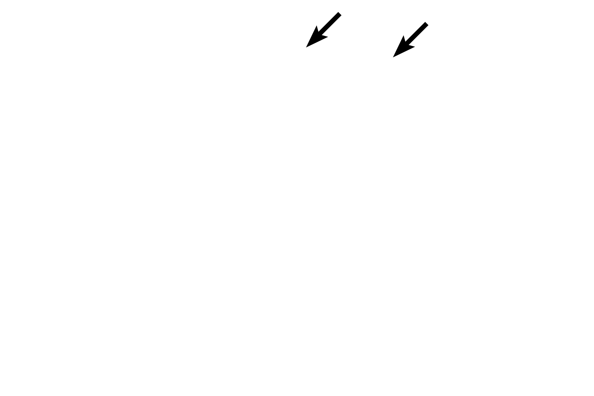 Endothelium <p>The transition from an elastic artery to a muscular one is gradual, so transitional arteries may show features of both arterial types. This section, stained with a trichrome stain, shows an artery in which the tunica media has characteristics of a medium, muscular artery (inner portion of smooth muscle) and a large, elastic artery (outer portion with elastic lamellae). 100x</p>
