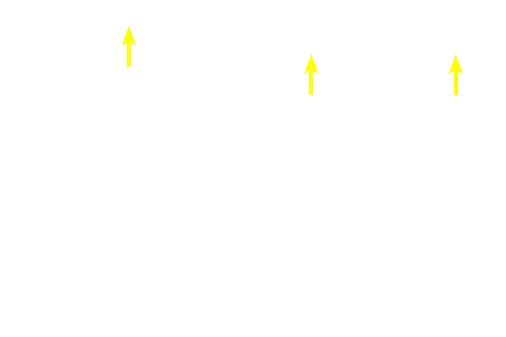 Internal elastic lamina <p>The transition from an elastic artery to a muscular one is gradual, so transitional arteries may show features of both arterial types. This section, stained with a trichrome stain, shows an artery in which the tunica media has characteristics of a medium, muscular artery (inner portion of smooth muscle) and a large, elastic artery (outer portion with elastic lamellae). 100x</p>
