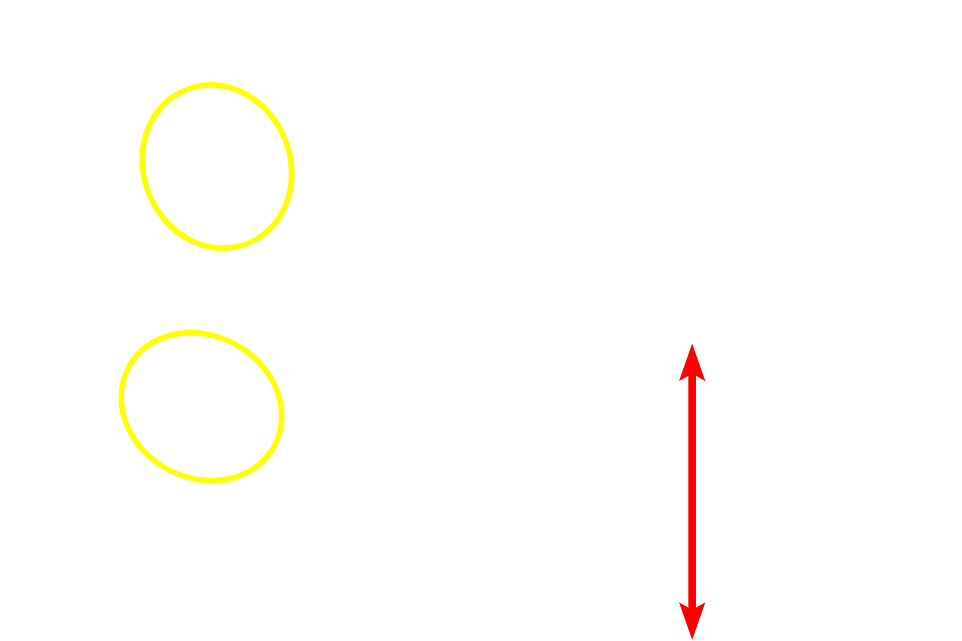 Endocrine cells <p>Fenestrated capillaries are present in locations, such as endocrine tissues, digestive system, and renal glomeruli, to facilitate transport through the capillary wall. On the left is a light micrograph of endocrine cells of the anterior pituitary gland. The electron micrograph on the right shows a pituitary cell adjacent to a fenestrated capillary. Fenestrations are only visible with the electron microscope. 1000x (left), 10,000x (right)</p>
