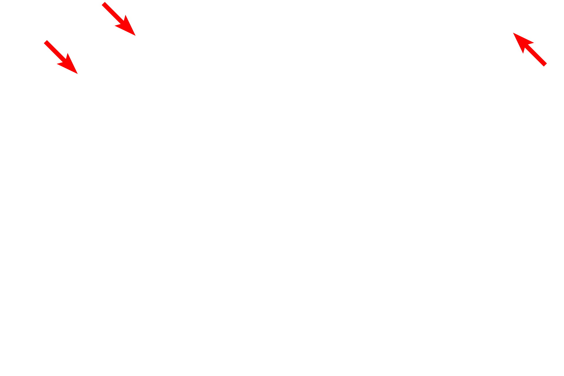  - Pericyte processes <p>The endothelium of this fenestrated capillary possesses clusters of small pores or fenestrations. Fenestrations are not open, rather, they are spanned by diaphragms derived from the glycocalyx. Diaphragms are lacking in the fenestrated capillaries of the renal glomerulus. 9000x</p>
