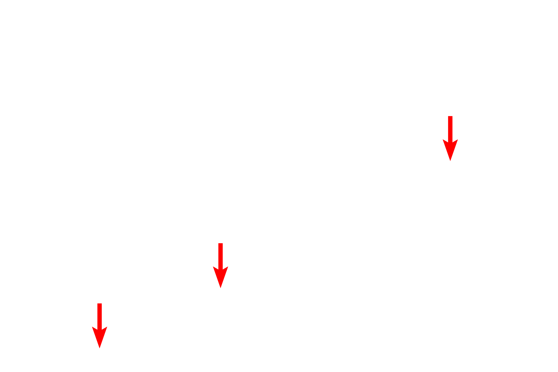  - Basal lamina of endothelial cell <p>This electron micrograph shows a capillary adjacent to the basal portion of a kidney tubule that is actively involved with water and ion movement between the urine in its lumen and the blood. The fenestrations in the endothelium facilitate this process. The tubule is composed of epithelial cells with numerous basal folds and an unusually thick basal lamina. 40,000x</p>
