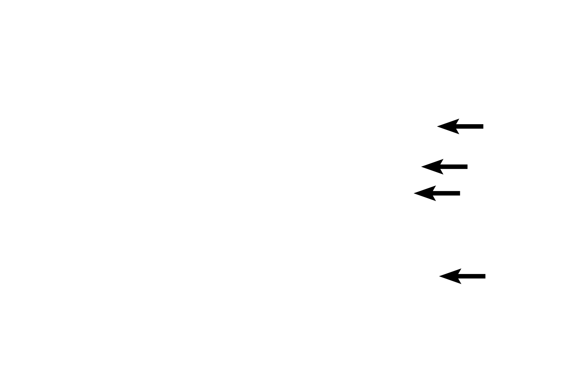 Discontinuous endothelium <p>Sinusoidal capillaries are specialized to permit maximal exchange of macromolecules as well as cells between tissues and the blood. Sinusoids (discontinuous capillaries) have wide lumens, much broader than other capillaries. They also have large gaps or discontinuities between adjacent endothelial cells as well as pores (fenestrations). The basal lamina is interrupted or may be completely absent. Sinusoids are present in the liver (seen here by light and electron microscopy), spleen, some endocrine organs and bone marrow. 1000x, 15,000x</p>
