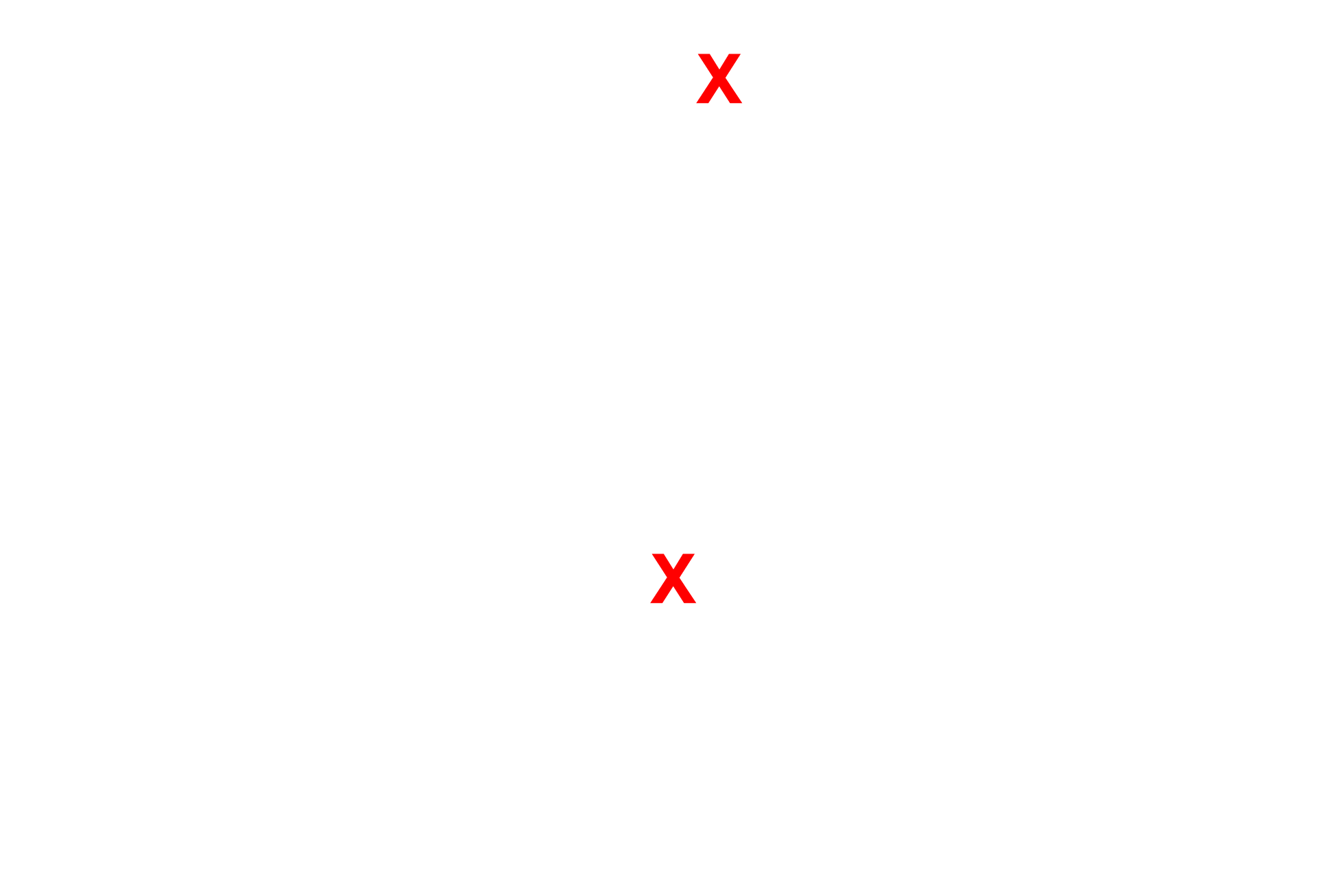 Sinusoid lumens <p>Endothelial cells that form sinusoids have large gaps (discontinuities) between adjacent endothelial cells as well as wide pores (fenestrations) in individual cells. These fenestrations do not have diaphragms. The basal lamina is discontinuous or absent. Shown here in the liver, these modifications allow for direct access of blood plasma to the space beneath the endothelium, into which hepatocytes project microvilli. 30,000x</p>
