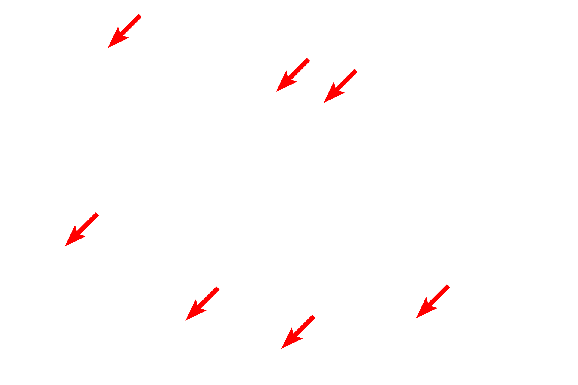  - Hepatocyte microvilli <p>Endothelial cells that form sinusoids have large gaps (discontinuities) between adjacent endothelial cells as well as wide pores (fenestrations) in individual cells. These fenestrations do not have diaphragms. The basal lamina is discontinuous or absent. Shown here in the liver, these modifications allow for direct access of blood plasma to the space beneath the endothelium, into which hepatocytes project microvilli. 30,000x</p>
