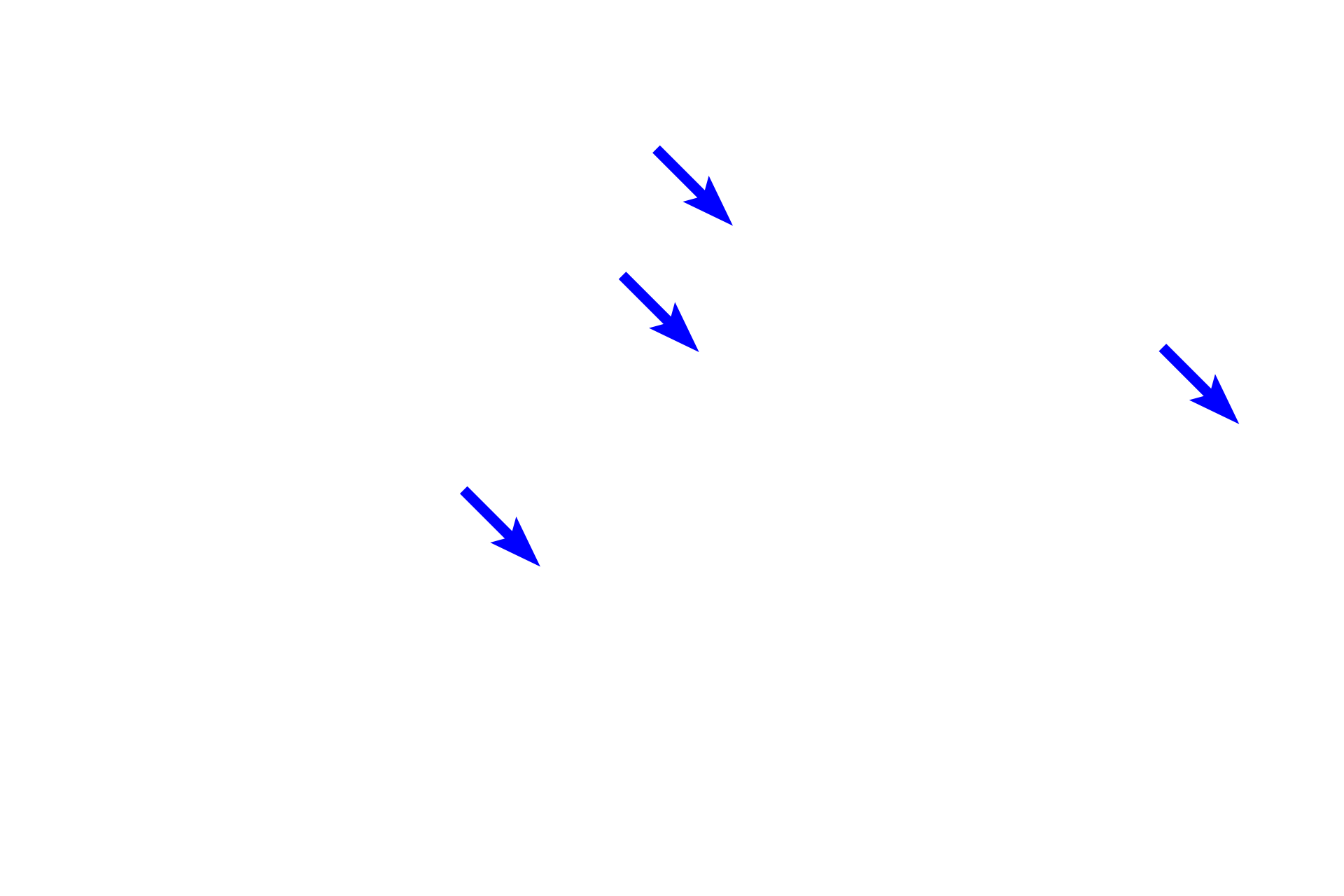  - Endothelial cell nuclei <p>The diameter of a continuous capillary is about equal to the width of a single red blood cell. Usually only one endothelial cell nucleus is visible in cross section, but sometimes two are visible. The cytoplasm of these cells is greatly attenuated and no fenestrations are present. A capillary has no additional tunics, but a pericyte may lie within the basal lamina of the endothelium. 1000x</p>
