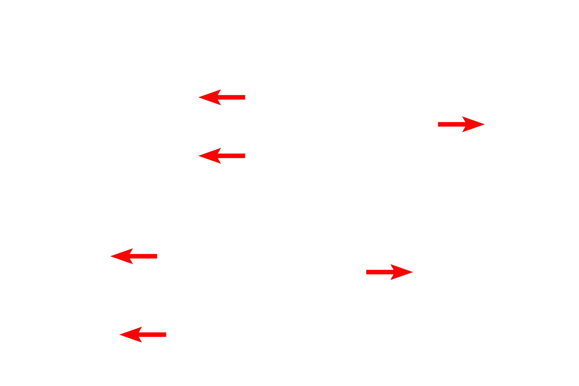 Capillaries <p>Continuous capillaries are plentiful in the lung, where gas exchange occurs between air in the lung and blood in the capillaries. This exchange occurs in small air sacs called alveoli whose wall contains numerous capillaries. Red and white blood cells can be seen in some of these capillaries. The features that distinguish a continuous from a discontinuous capillary are not visible with the light microscope. 1000x</p>

