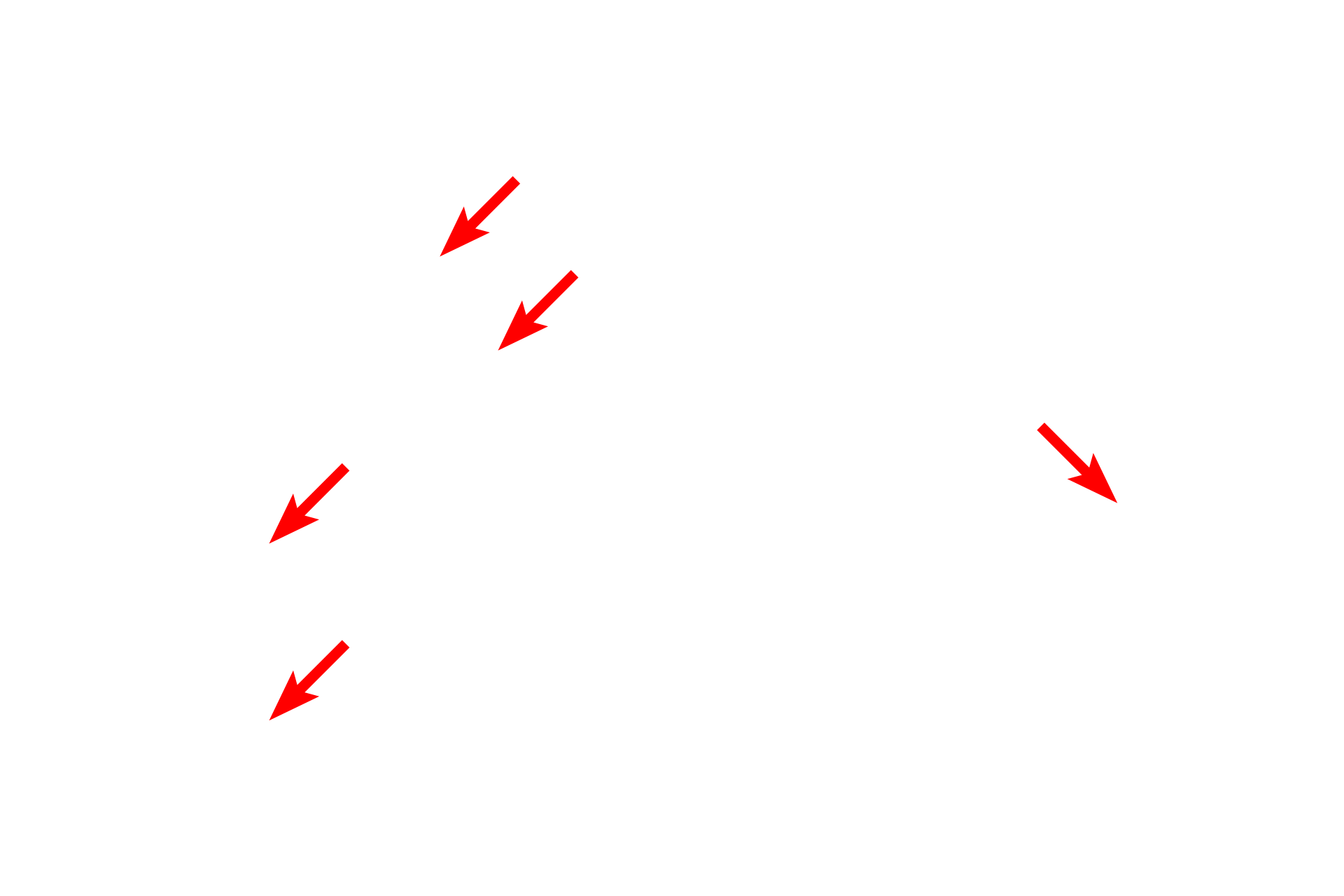  - Endothelial cells <p>Continuous capillaries are plentiful in the lung, where gas exchange occurs between air in the lung and blood in the capillaries. This exchange occurs in small air sacs called alveoli whose wall contains numerous capillaries. Red and white blood cells can be seen in some of these capillaries. The features that distinguish a continuous from a discontinuous capillary are not visible with the light microscope. 1000x</p>
