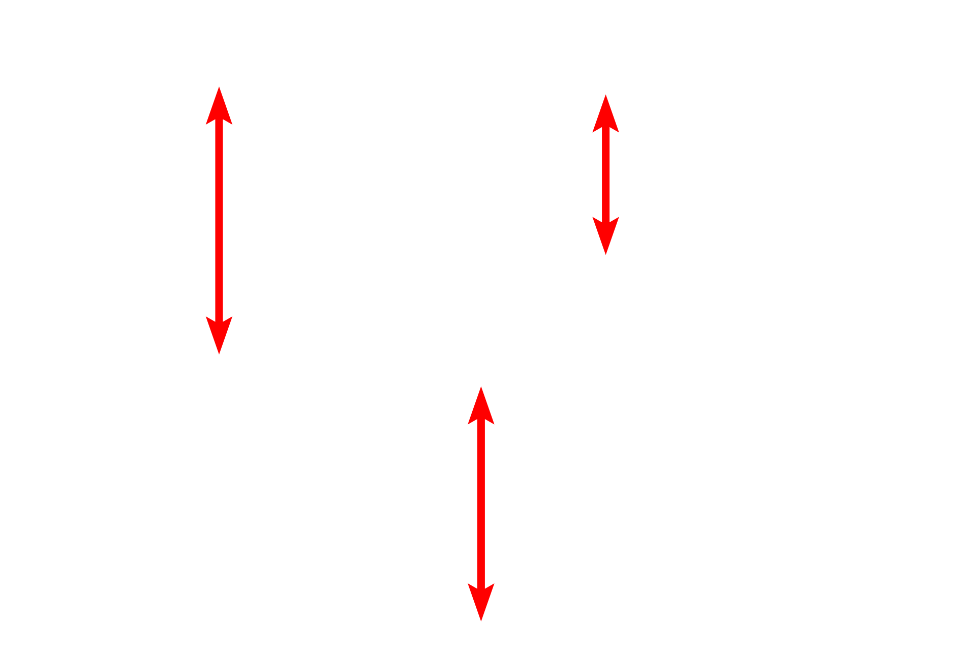Capillaries <p>This electron micrograph shows the capillaries displayed in the previous light micrograph. Note their extremely thin walls, consisting mostly of the endothelial cell, which facilitates the exchange of respiratory gases between inhaled air in the air spaces and the blood stream. The air spaces are lined by a thin epithelial cell layer that covers the exterior of the capillaries. 10,000x</p>

