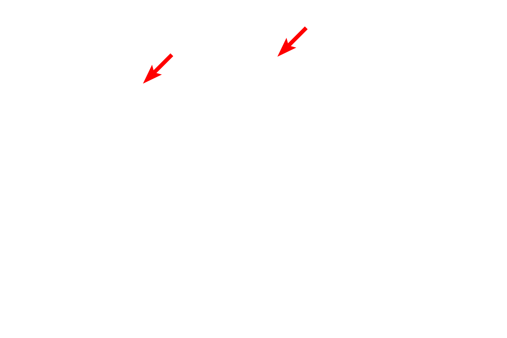  - Endothelial cell nuclei <p>This electron micrograph shows the capillaries displayed in the previous light micrograph. Note their extremely thin walls, consisting mostly of the endothelial cell, which facilitates the exchange of respiratory gases between inhaled air in the air spaces and the blood stream. The air spaces are lined by a thin epithelial cell layer that covers the exterior of the capillaries. 10,000x</p>
