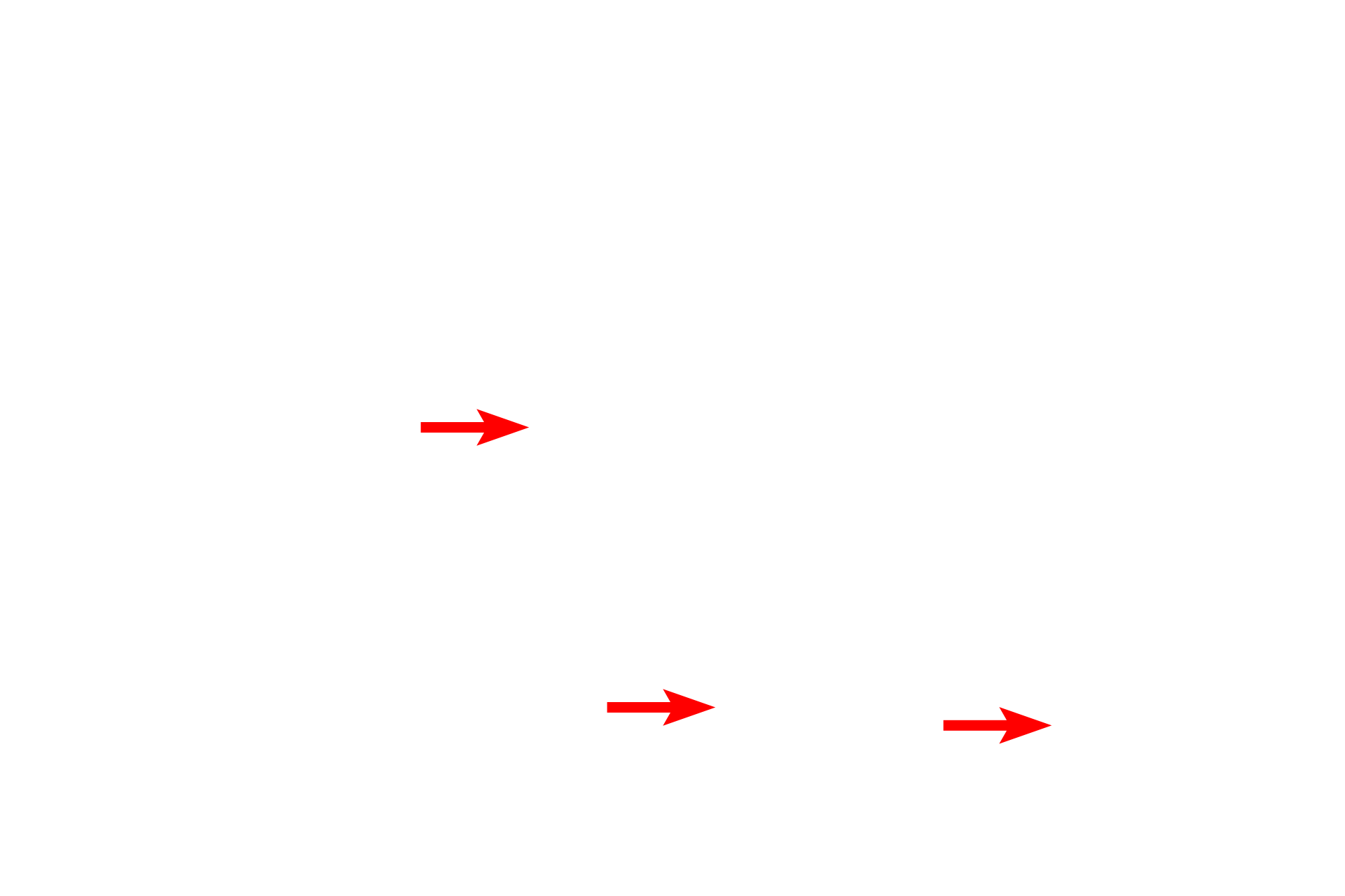 Red blood cells <p>This electron micrograph shows the capillaries displayed in the previous light micrograph. Note their extremely thin walls, consisting mostly of the endothelial cell, which facilitates the exchange of respiratory gases between inhaled air in the air spaces and the blood stream. The air spaces are lined by a thin epithelial cell layer that covers the exterior of the capillaries. 10,000x</p>
