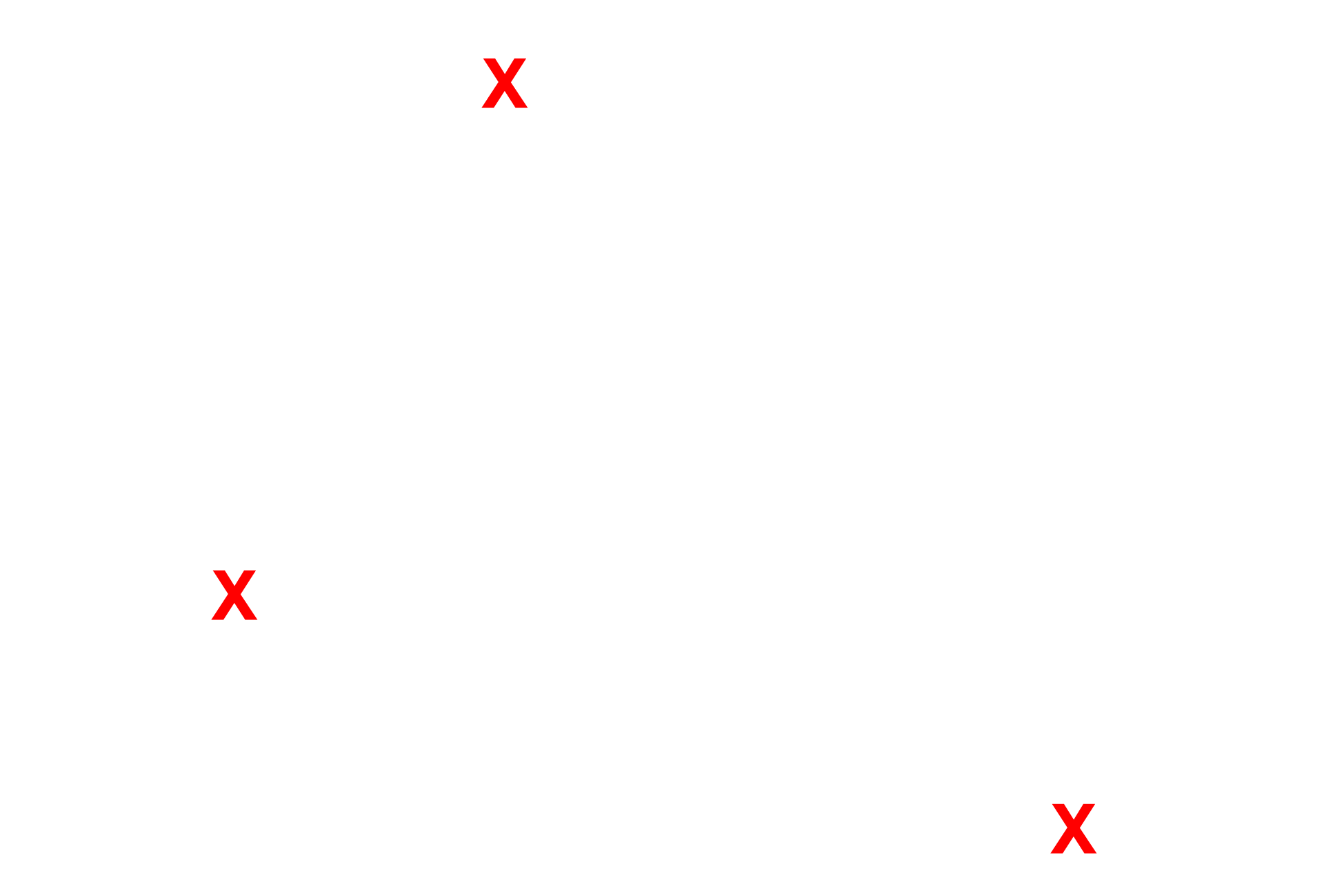 Air spaces <p>This electron micrograph shows the capillaries displayed in the previous light micrograph. Note their extremely thin walls, consisting mostly of the endothelial cell, which facilitates the exchange of respiratory gases between inhaled air in the air spaces and the blood stream. The air spaces are lined by a thin epithelial cell layer that covers the exterior of the capillaries. 10,000x</p>
