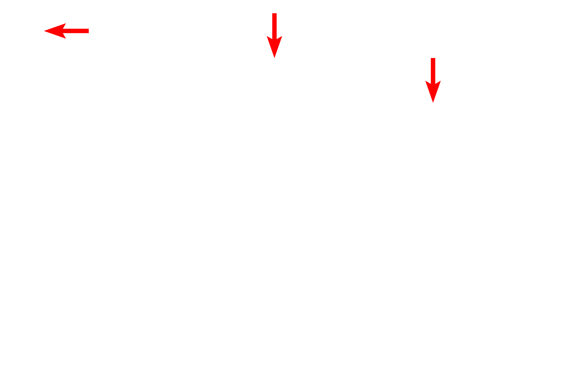  - Epithelial cell <p>This electron micrograph shows the capillaries displayed in the previous light micrograph. Note their extremely thin walls, consisting mostly of the endothelial cell, which facilitates the exchange of respiratory gases between inhaled air in the air spaces and the blood stream. The air spaces are lined by a thin epithelial cell layer that covers the exterior of the capillaries. 10,000x</p>
