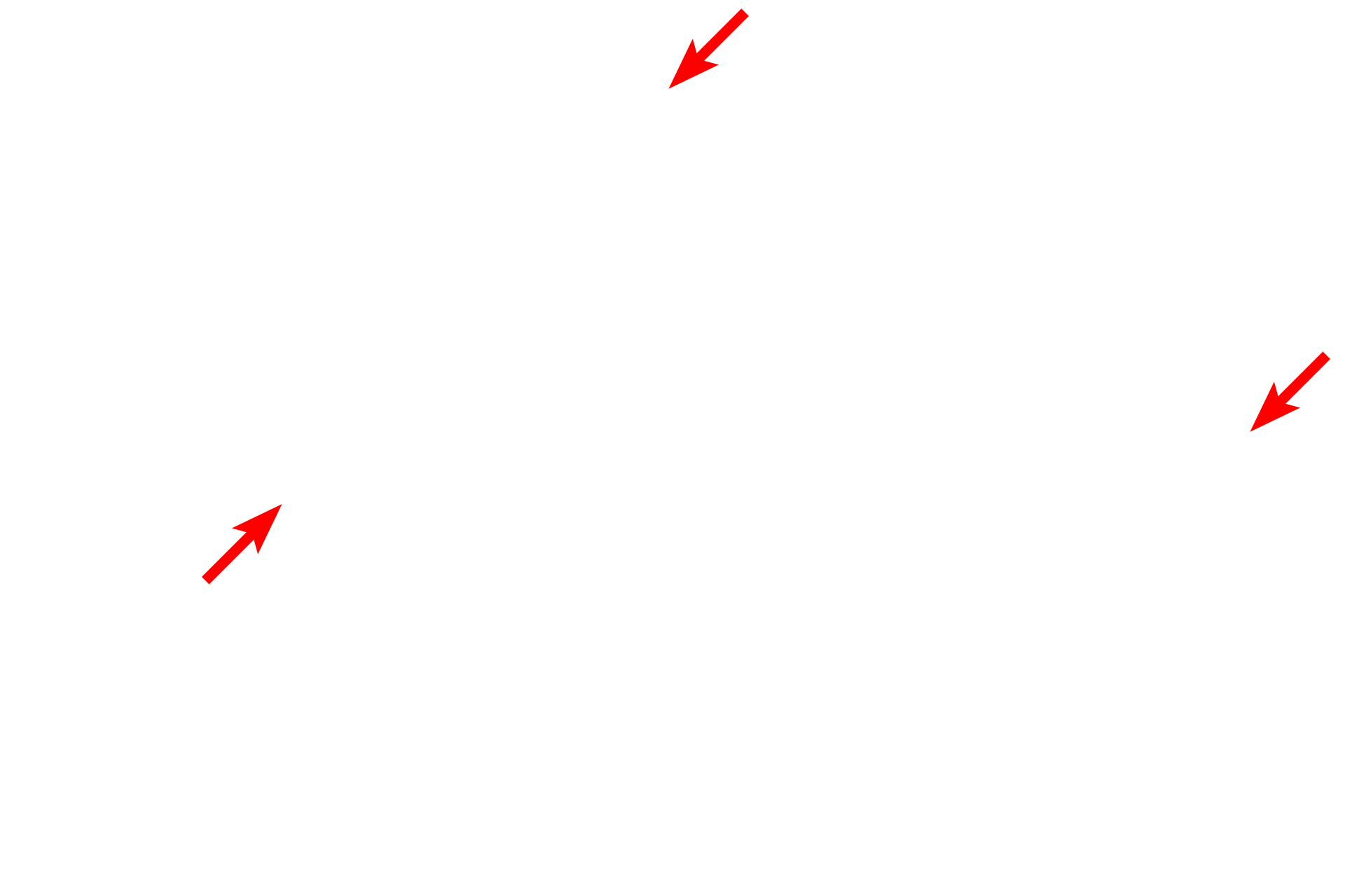 Basal lamina <p>This slightly tangential section of a capillary reveals a wall formed by four endothelial cells that form a mosaic as they compose the wall. None of their nuclei are visible here. The margins of adjacent endothelial cells demonstrate junctional complexes, including tight junctions to reduce leakage from the lumen. The plasma membranes often interdigitate at these junctional sites. A higher magnification view of each these junctions is shown in the lower panels. 10,000x</p>
