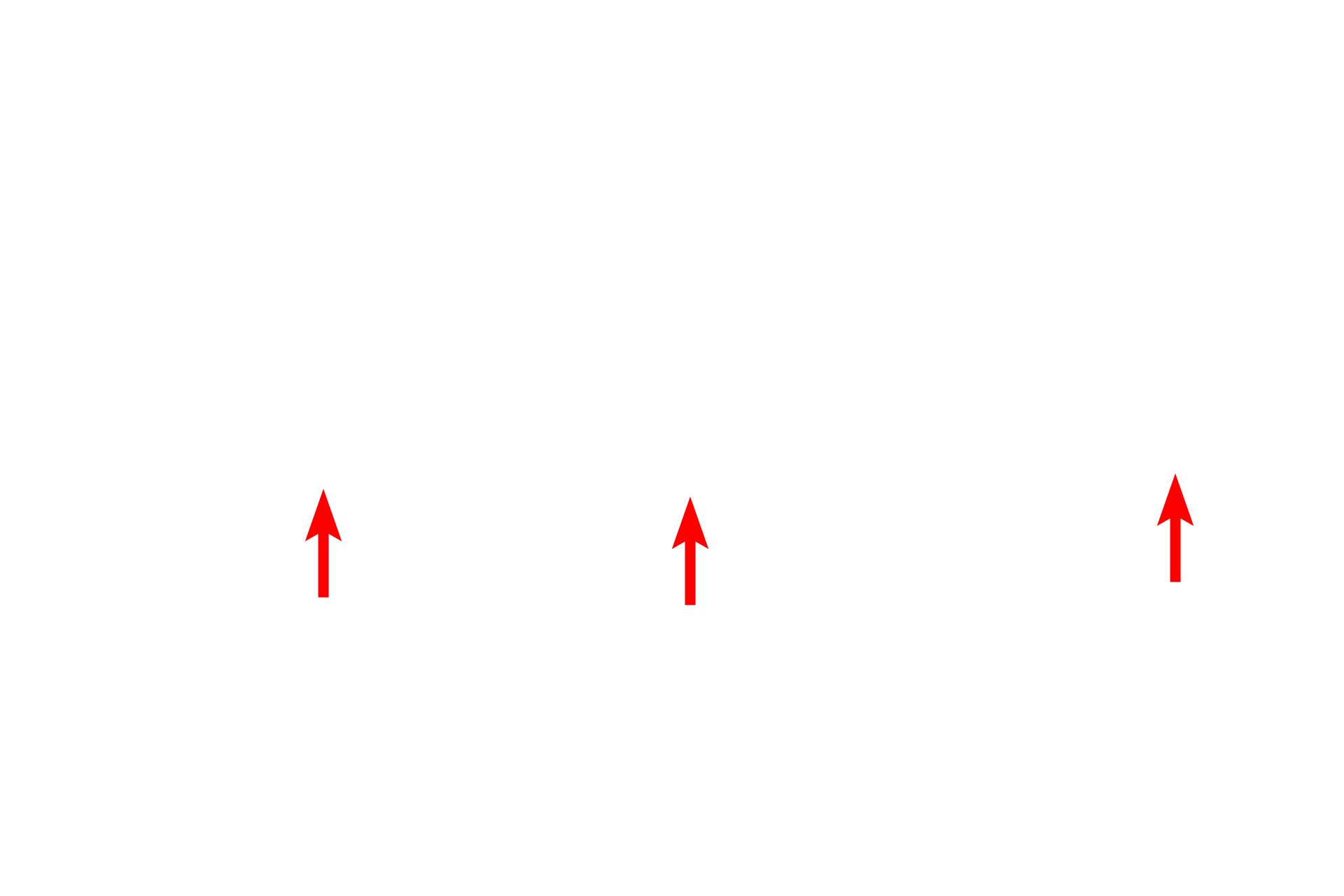  - Basal lamina <p>This electron micrograph shows a high magnification view of the basal surface of an endothelial cell. In a continuous capillary, no pores are present in the endothelium, and macromolecules are transported in both directions through the endothelial cytoplasm via pinocytotic vesicles. This bidirectional process is called transcytosis. Some molecules are able to diffuse across the endothelium, such as small ions, amino acids and gases. The endothelium rests on a basal lamina that it has produced. 45,000x</p>
