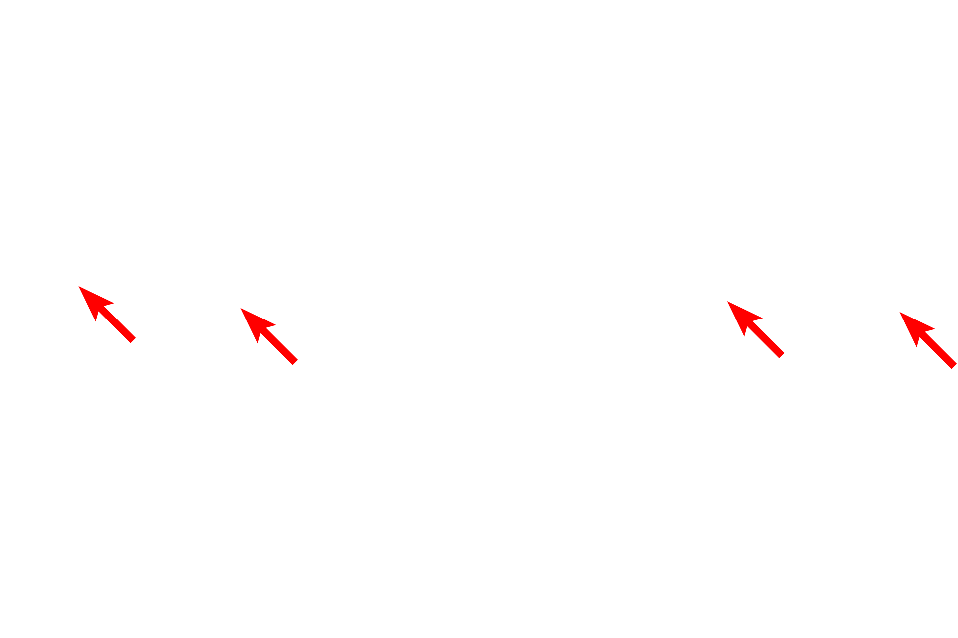  - Pinocytic vesicles <p>This electron micrograph shows a high magnification view of the basal surface of an endothelial cell. In a continuous capillary, no pores are present in the endothelium, and macromolecules are transported in both directions through the endothelial cytoplasm via pinocytotic vesicles. This bidirectional process is called transcytosis. Some molecules are able to diffuse across the endothelium, such as small ions, amino acids and gases. The endothelium rests on a basal lamina that it has produced. 45,000x</p>
