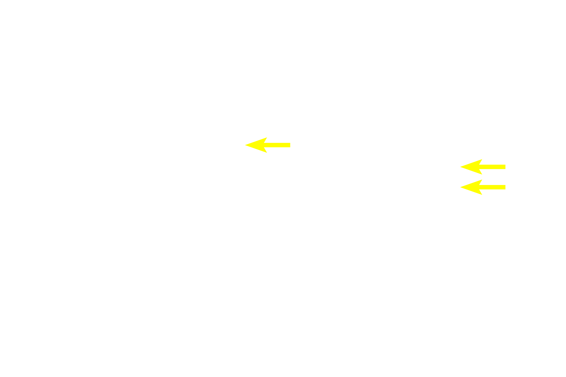 Tunica media <p>Several characteristics differentiate arteries from their accompanying veins. Proportionally, arteries have narrower lumens and thicker walls than do veins. Veins are usually larger in diameter with wider lumens than their accompanying arteries. The tunica media is the predominant layer in arteries while the tunica adventitia generally is the thickest layer in veins.</p>

